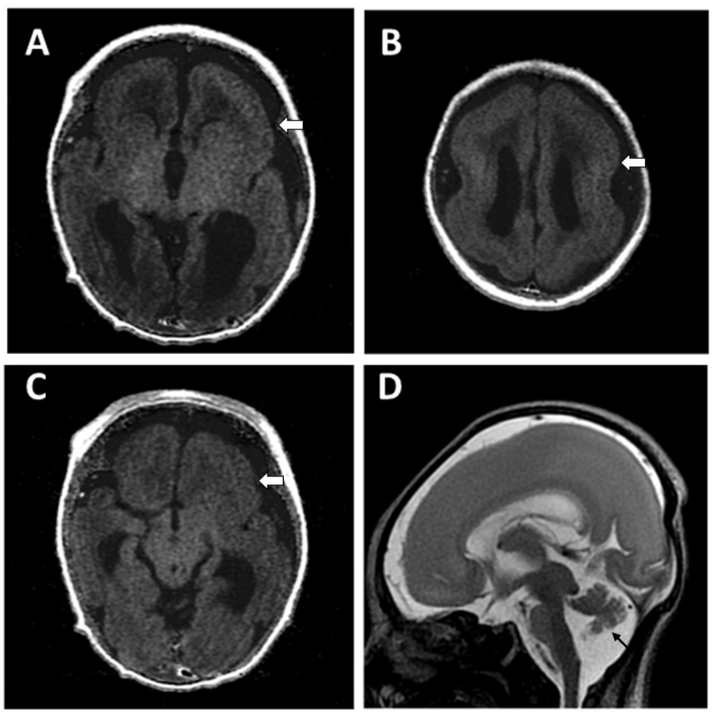 Children 09 01105 g005