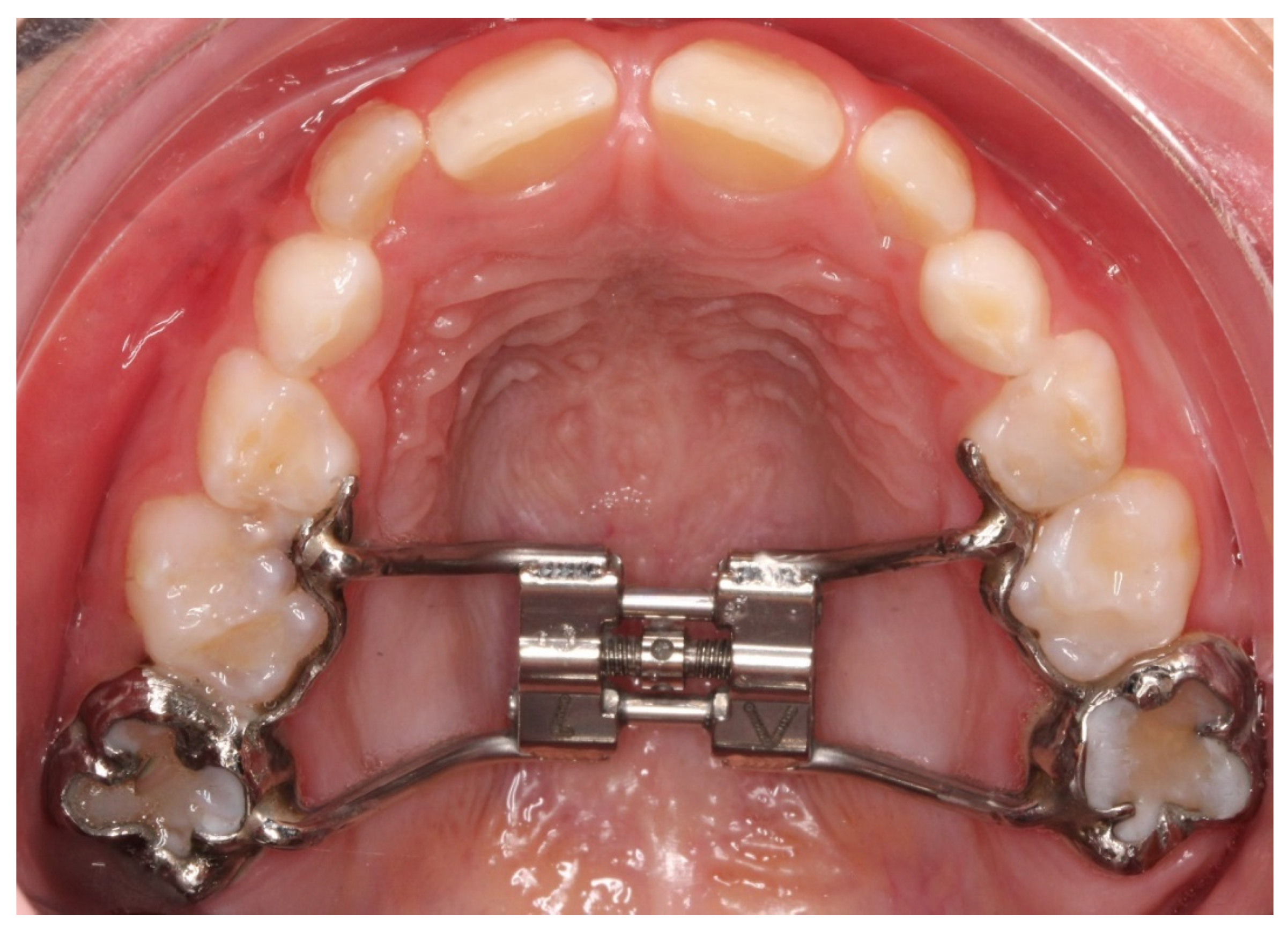 Children 09 01107 g006 550