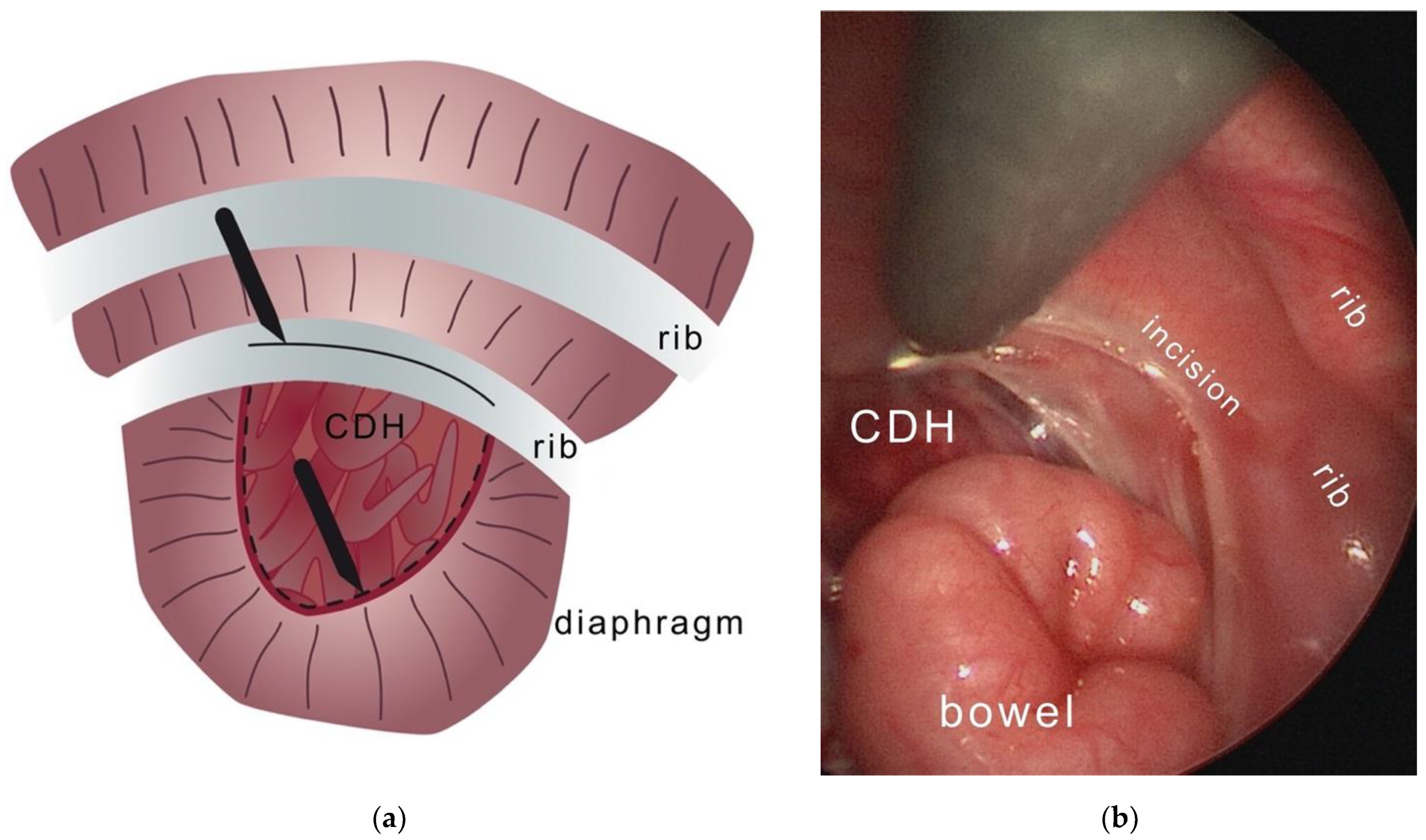 Children 09 01116 g002