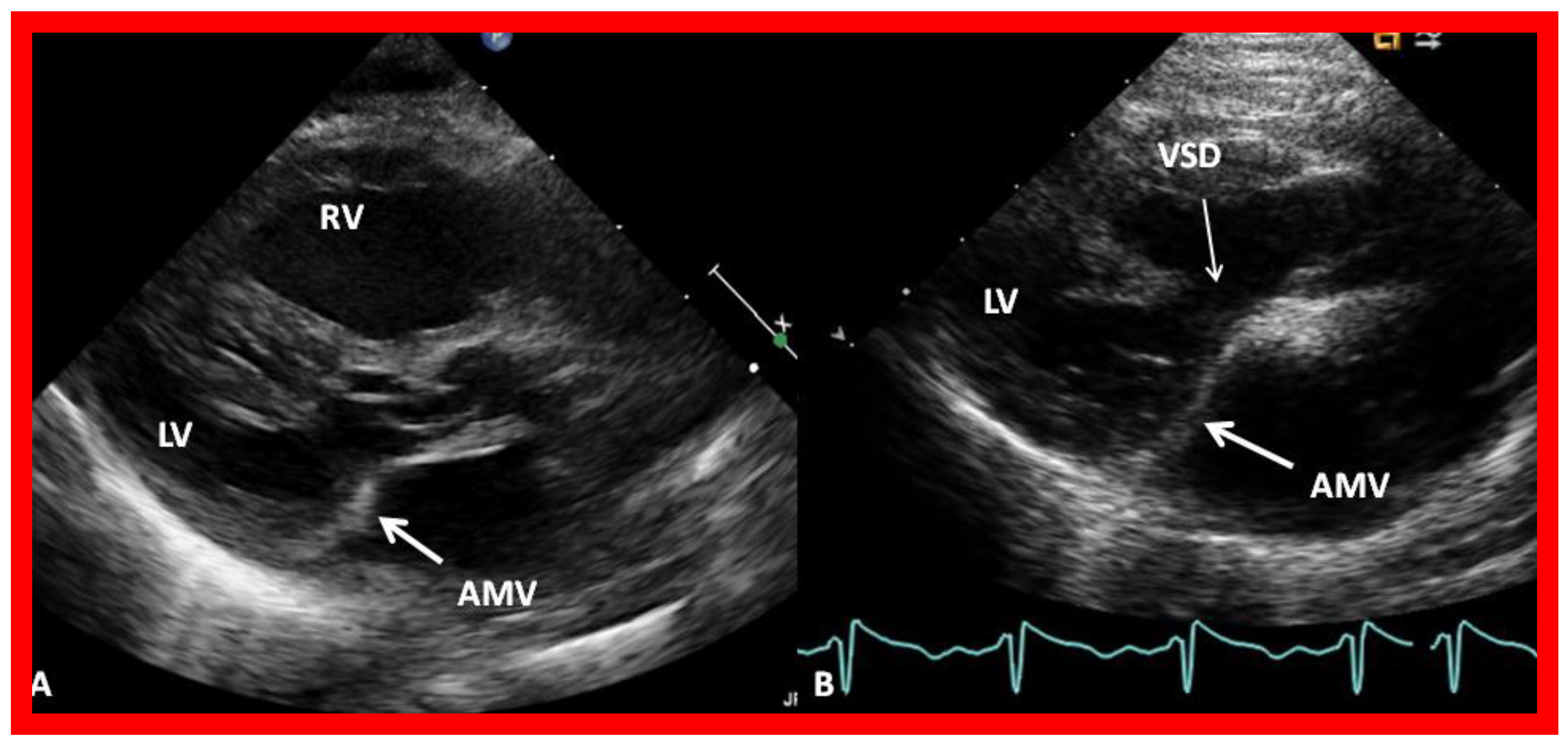 Children 09 01148 g002 550