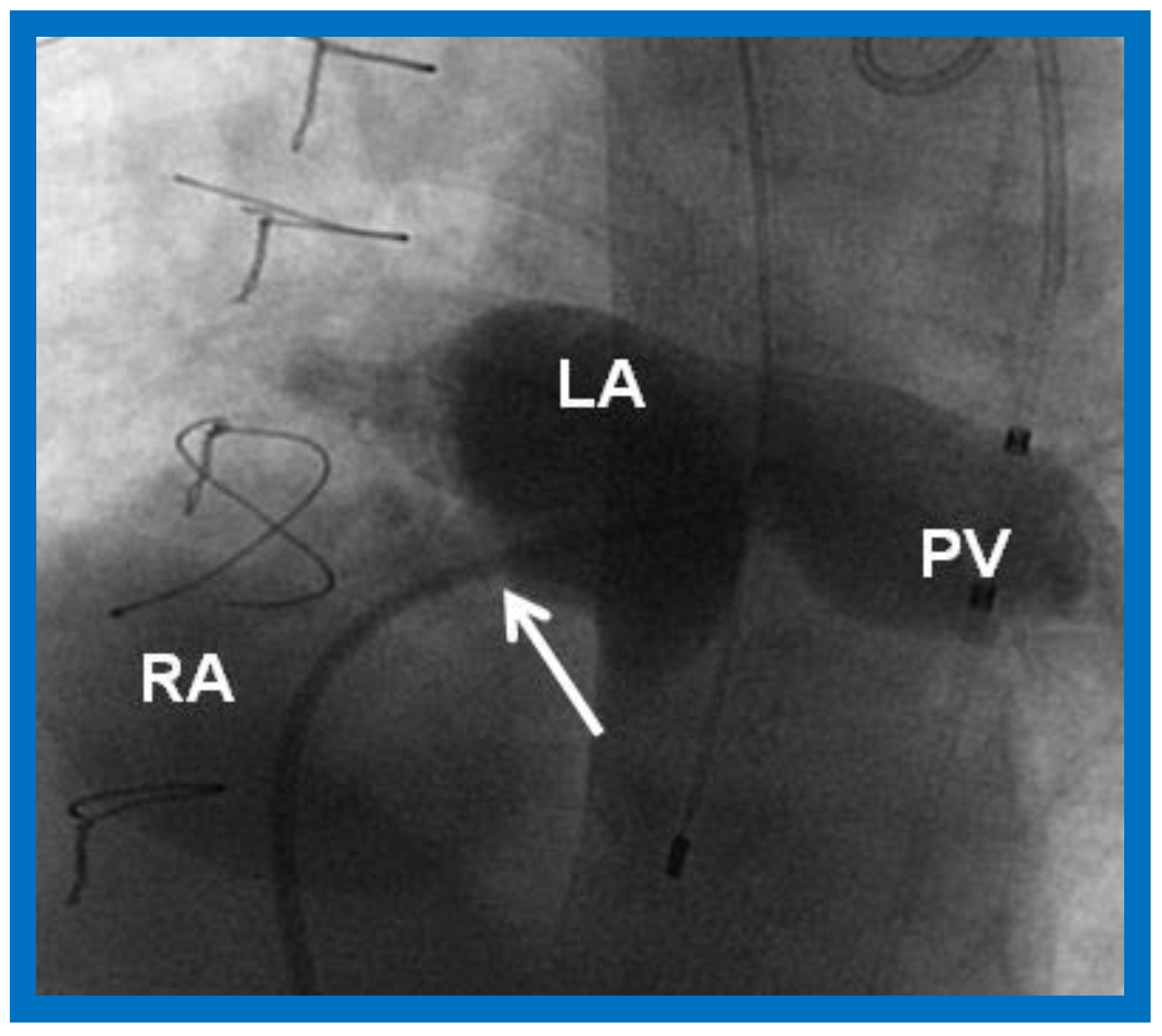 Children 09 01148 g005 550