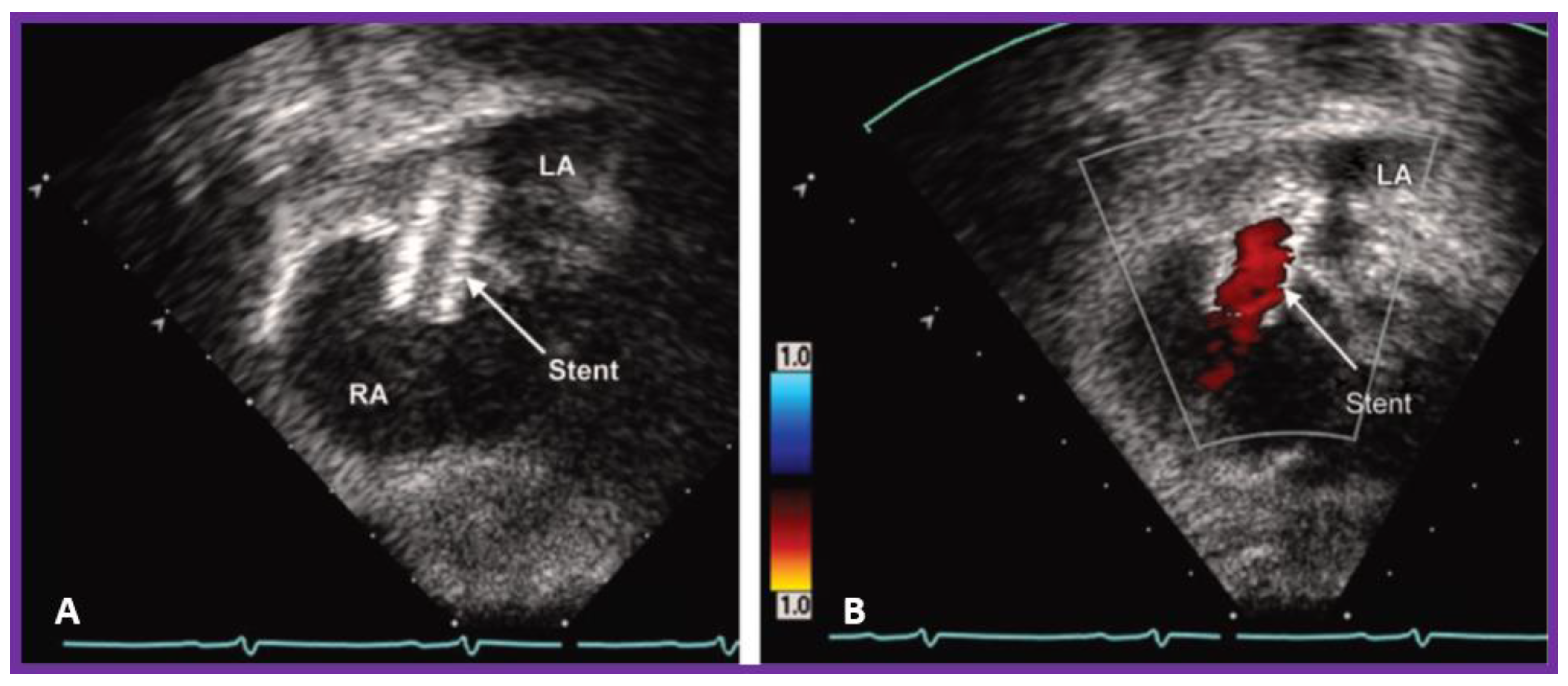 Children 09 01148 g008 550