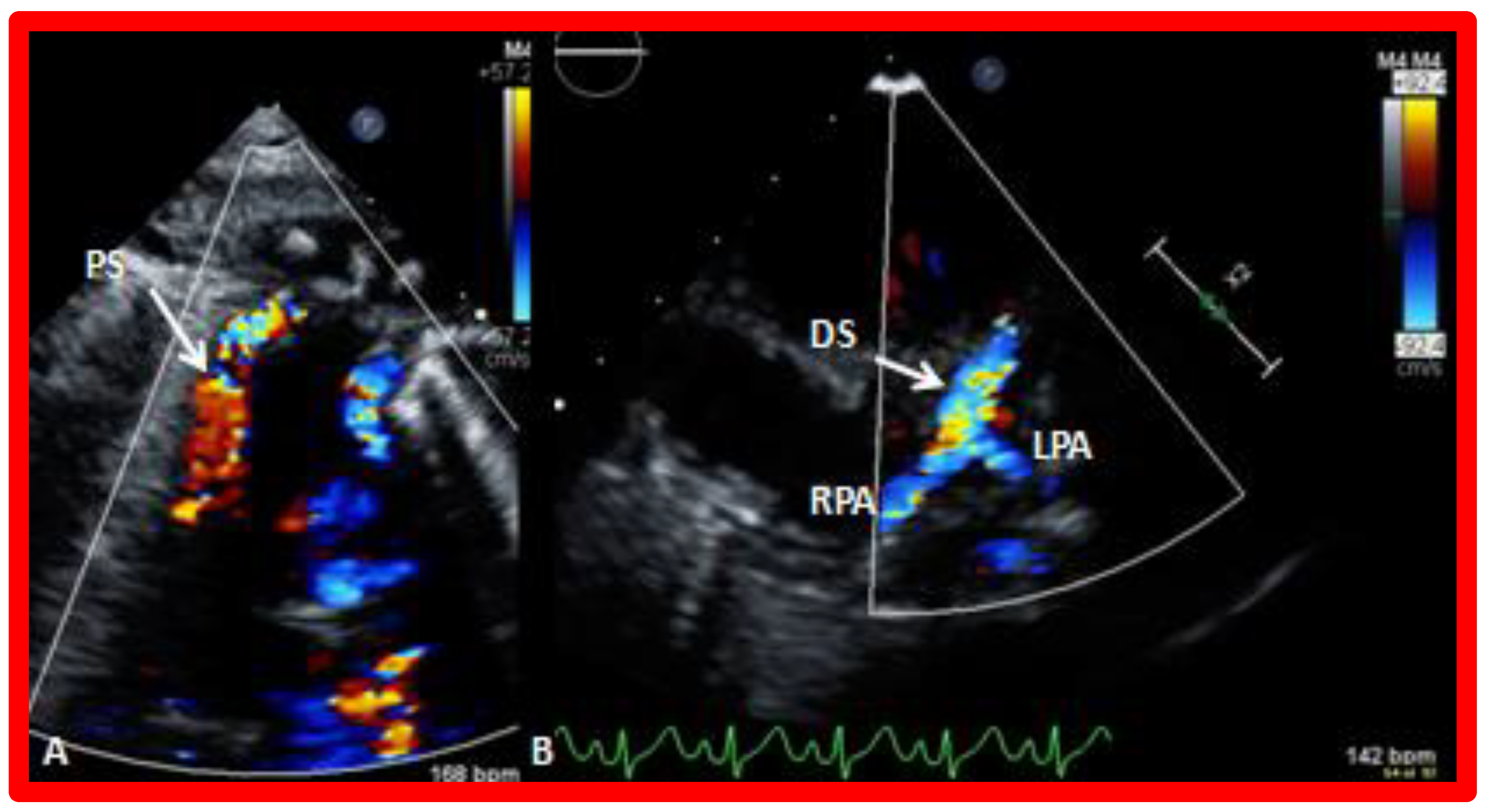 Children 09 01148 g010 550