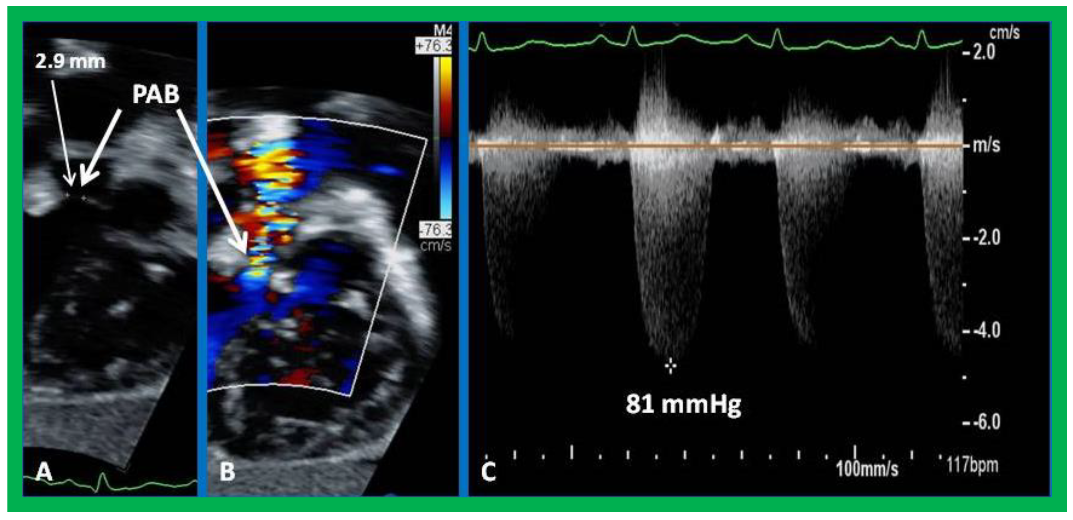 Children 09 01148 g011 550