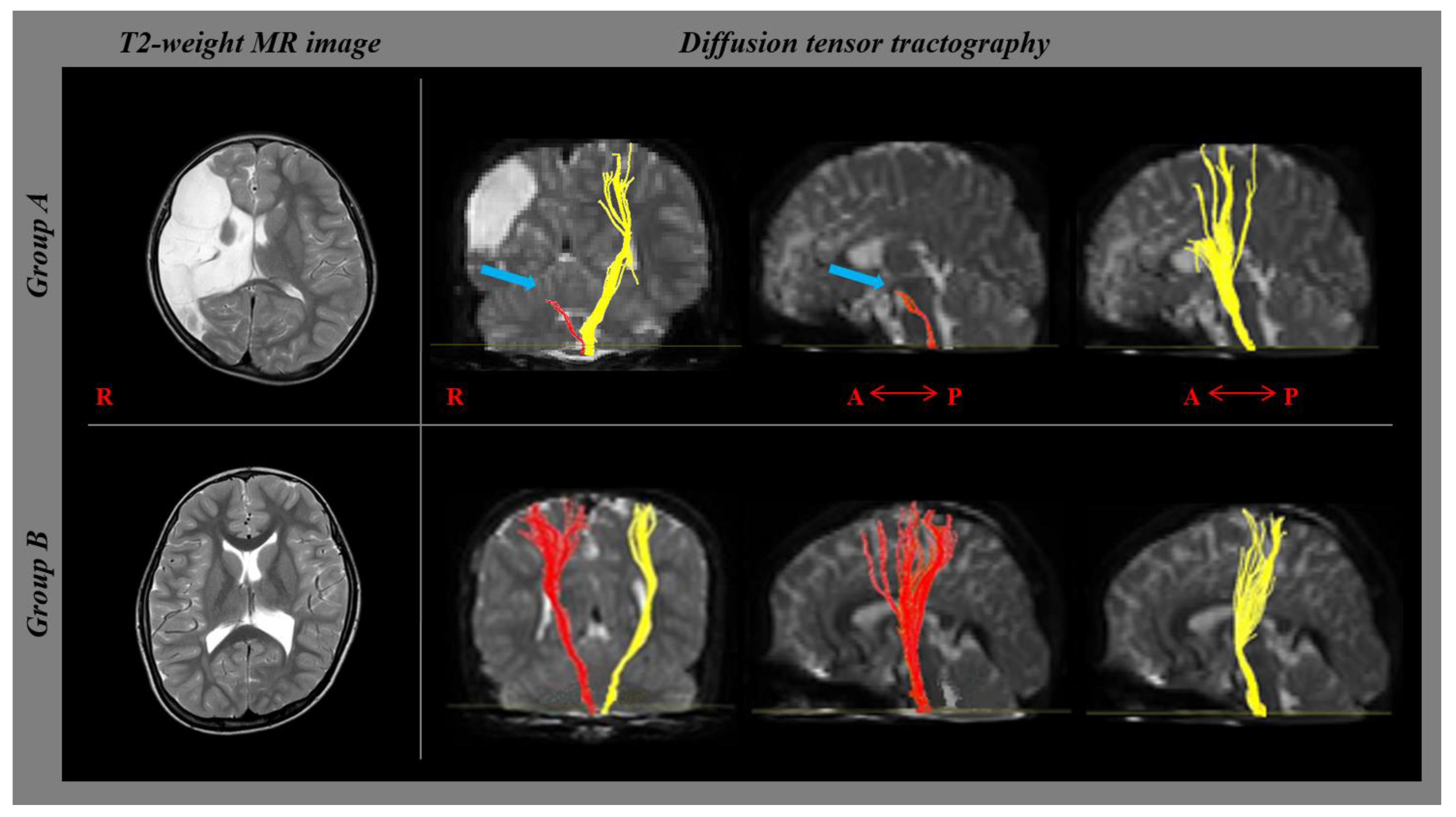 Children 09 01198 g002 Children 09 01198 g002