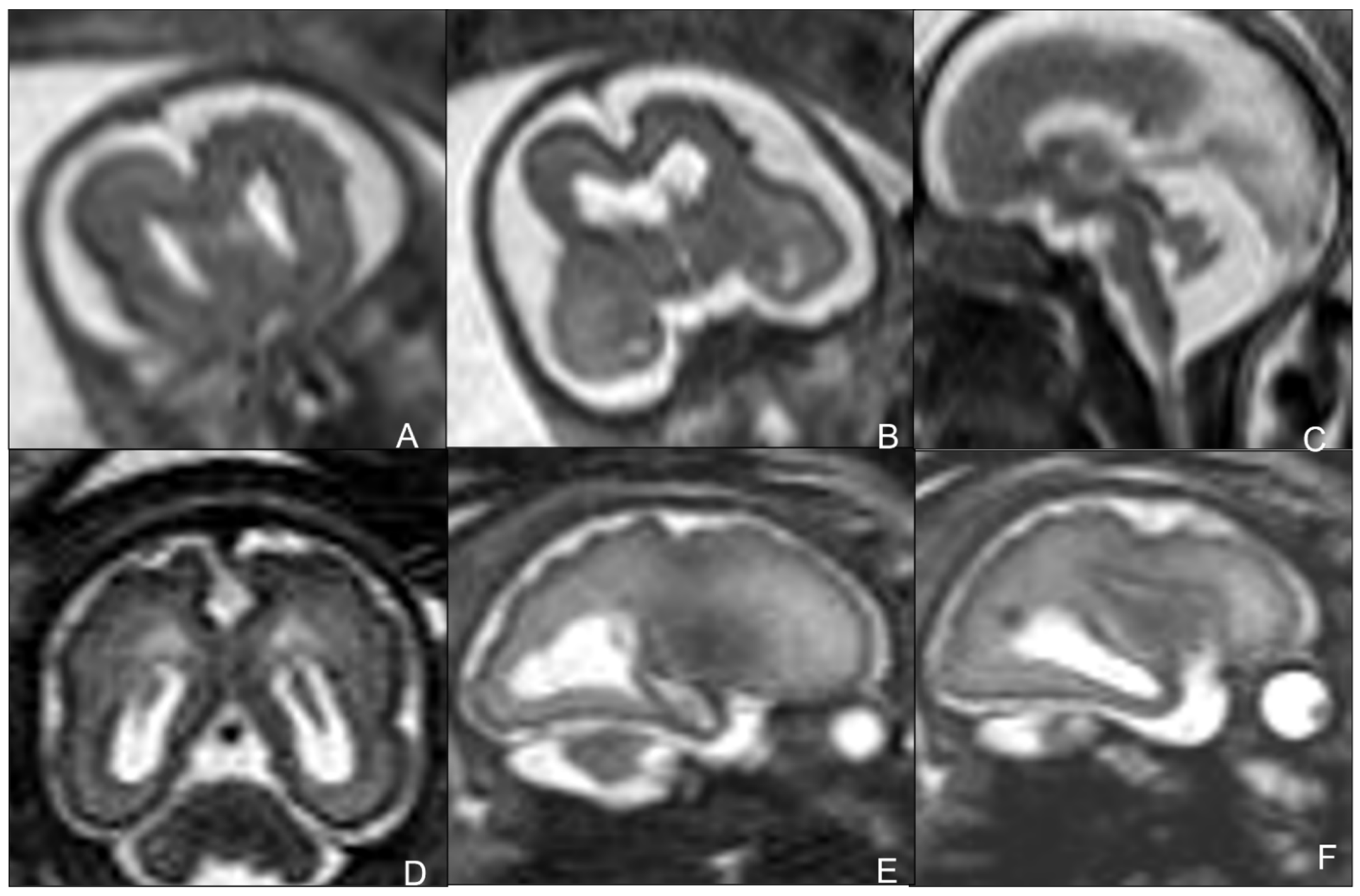 Children 09 01210 g003 550