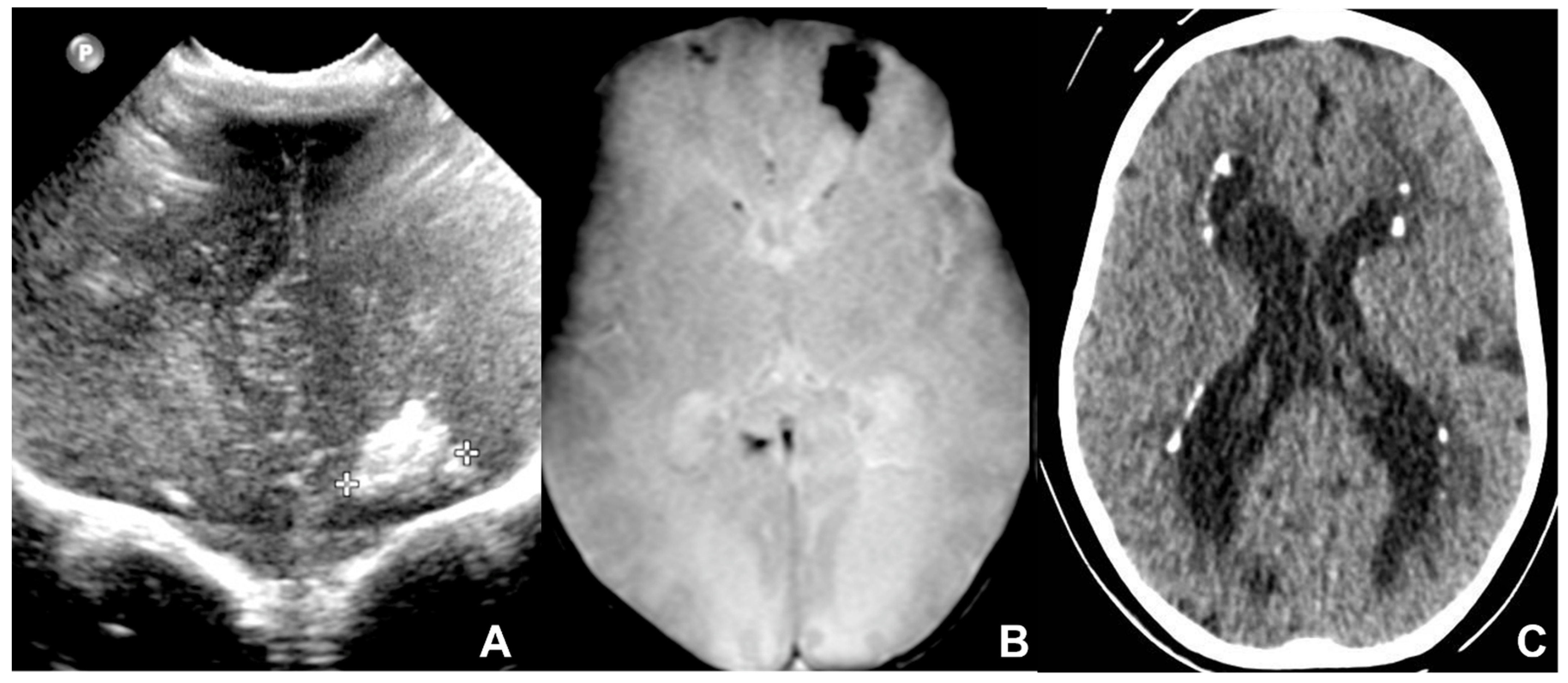 Children 09 01210 g004 550