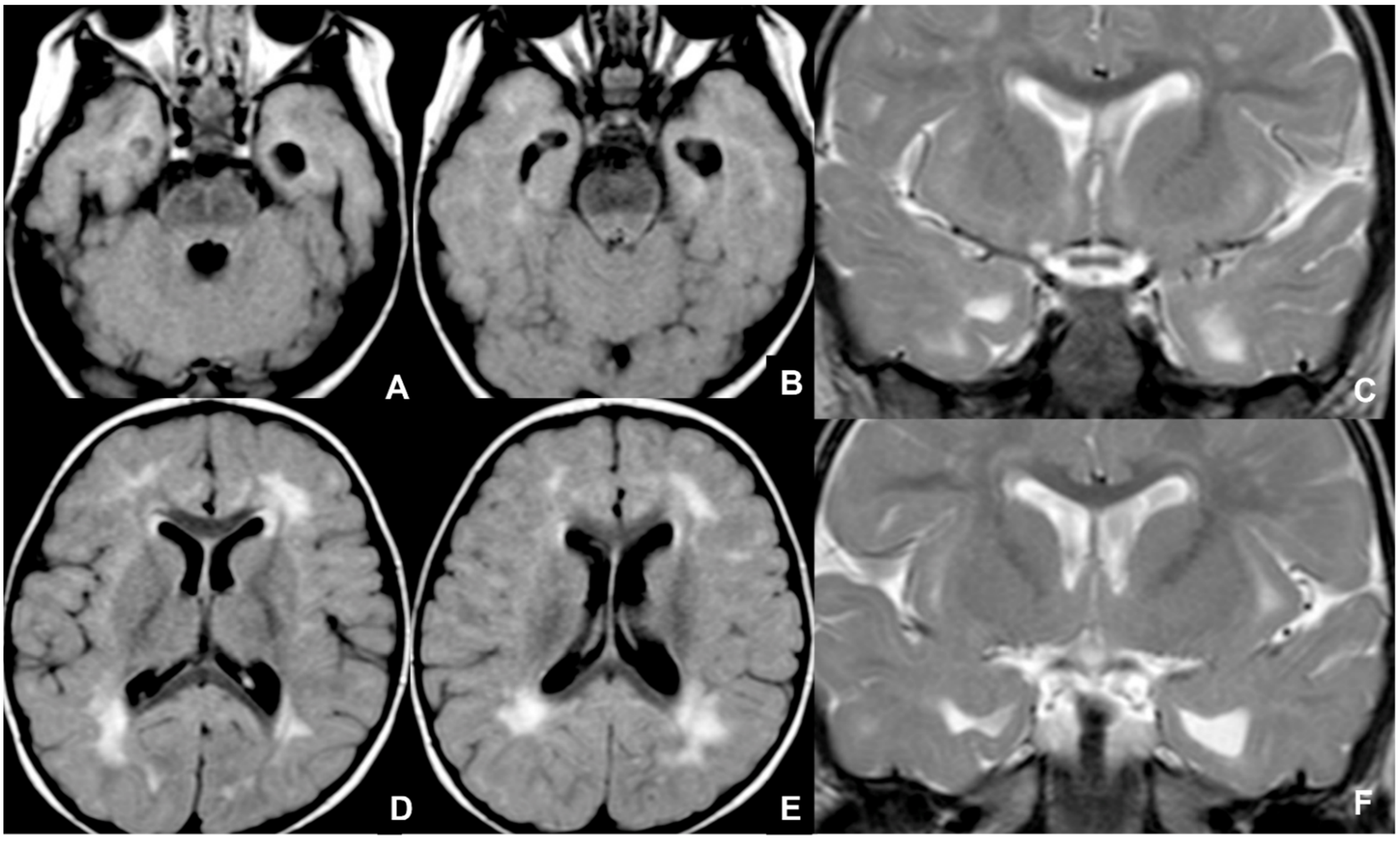 Children 09 01210 g007 550