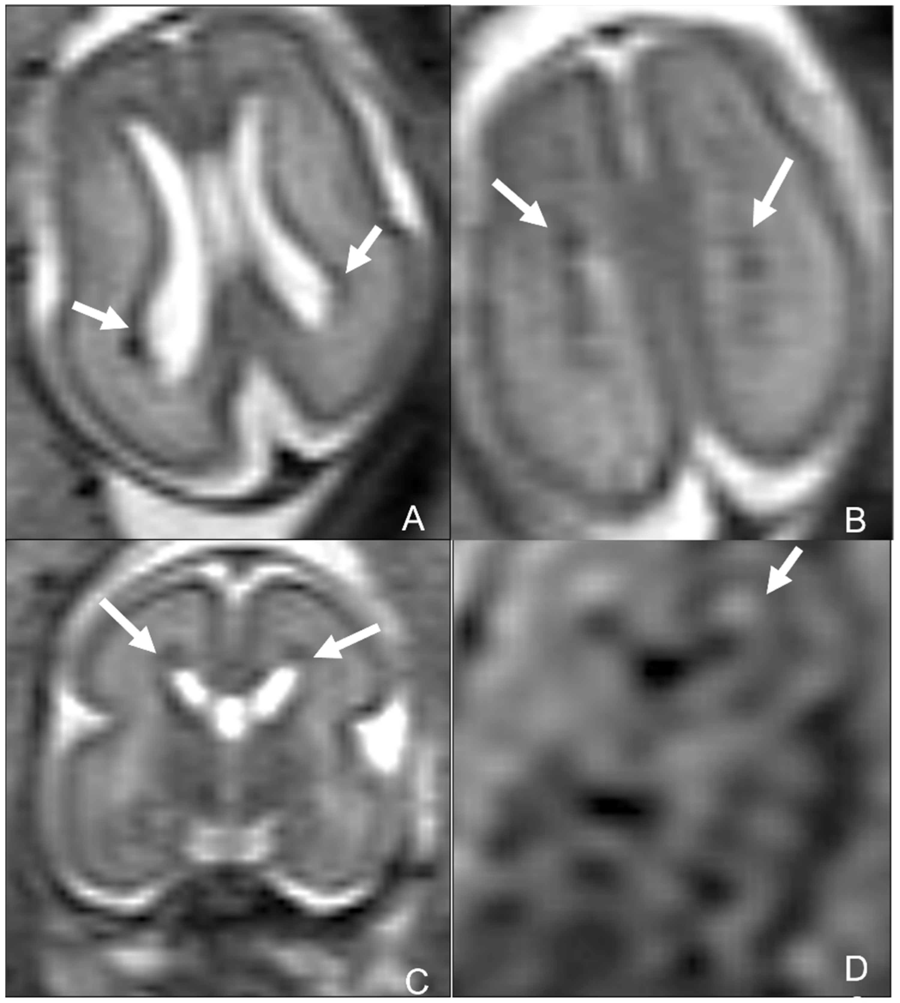 Children 09 01210 g015 550