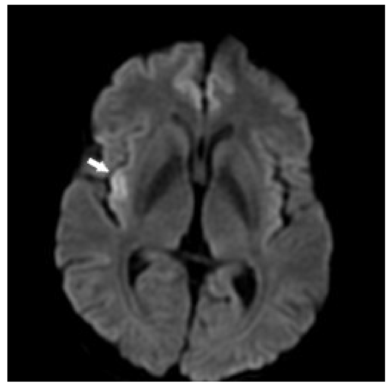 Children 09 01217 g005 550