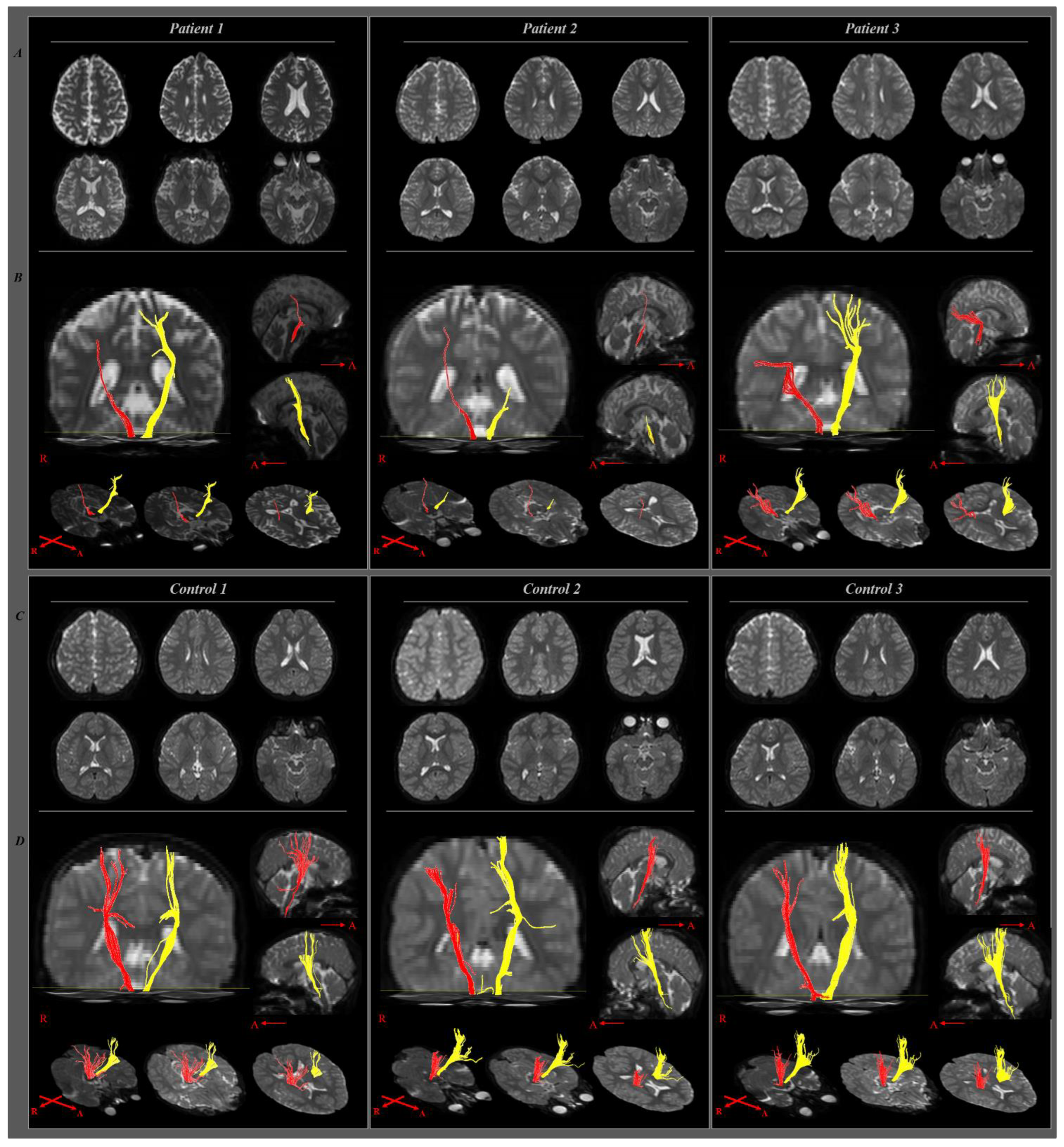 Children 09 01223 g002 550