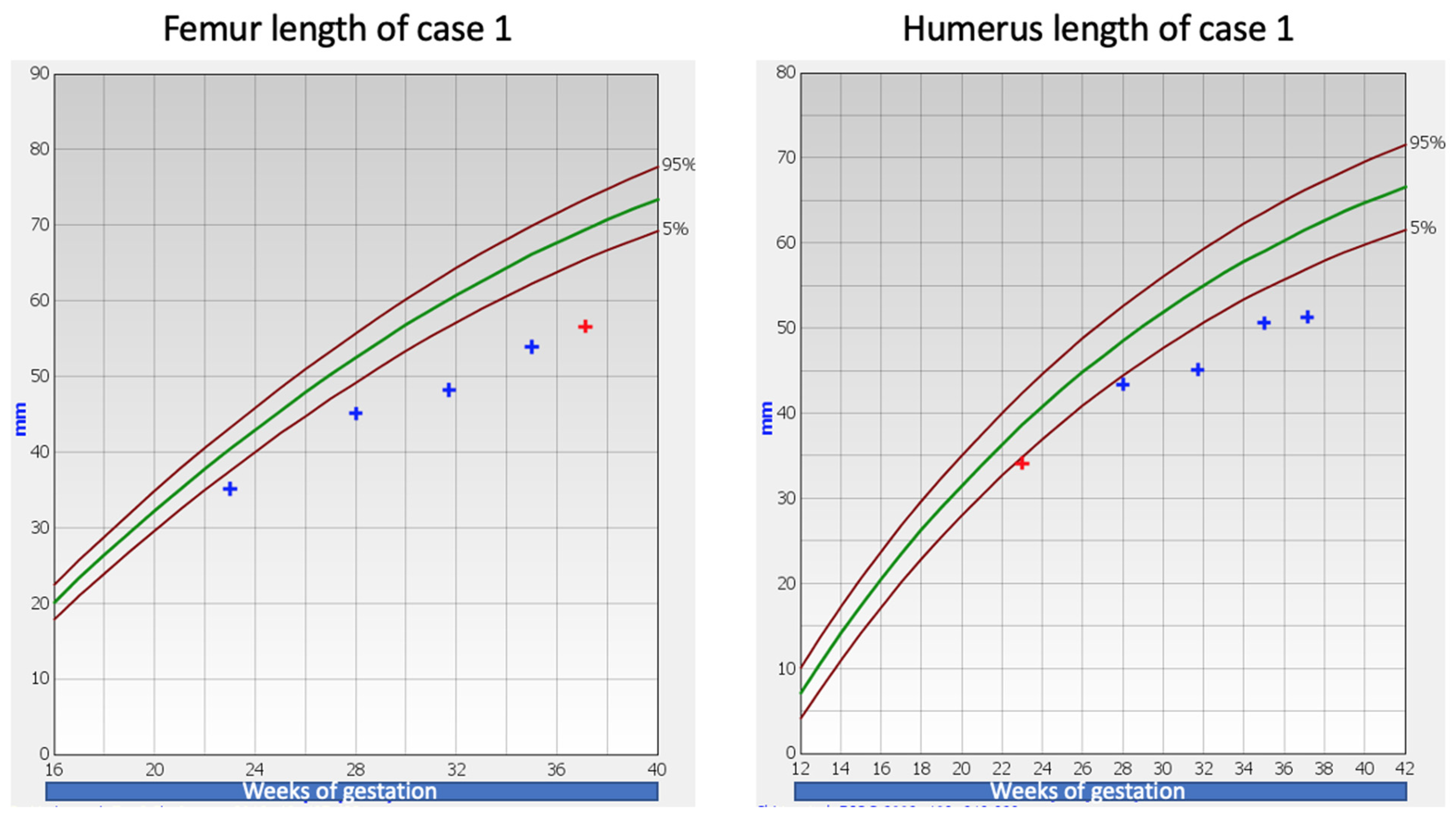 Children 09 01229 g001 550