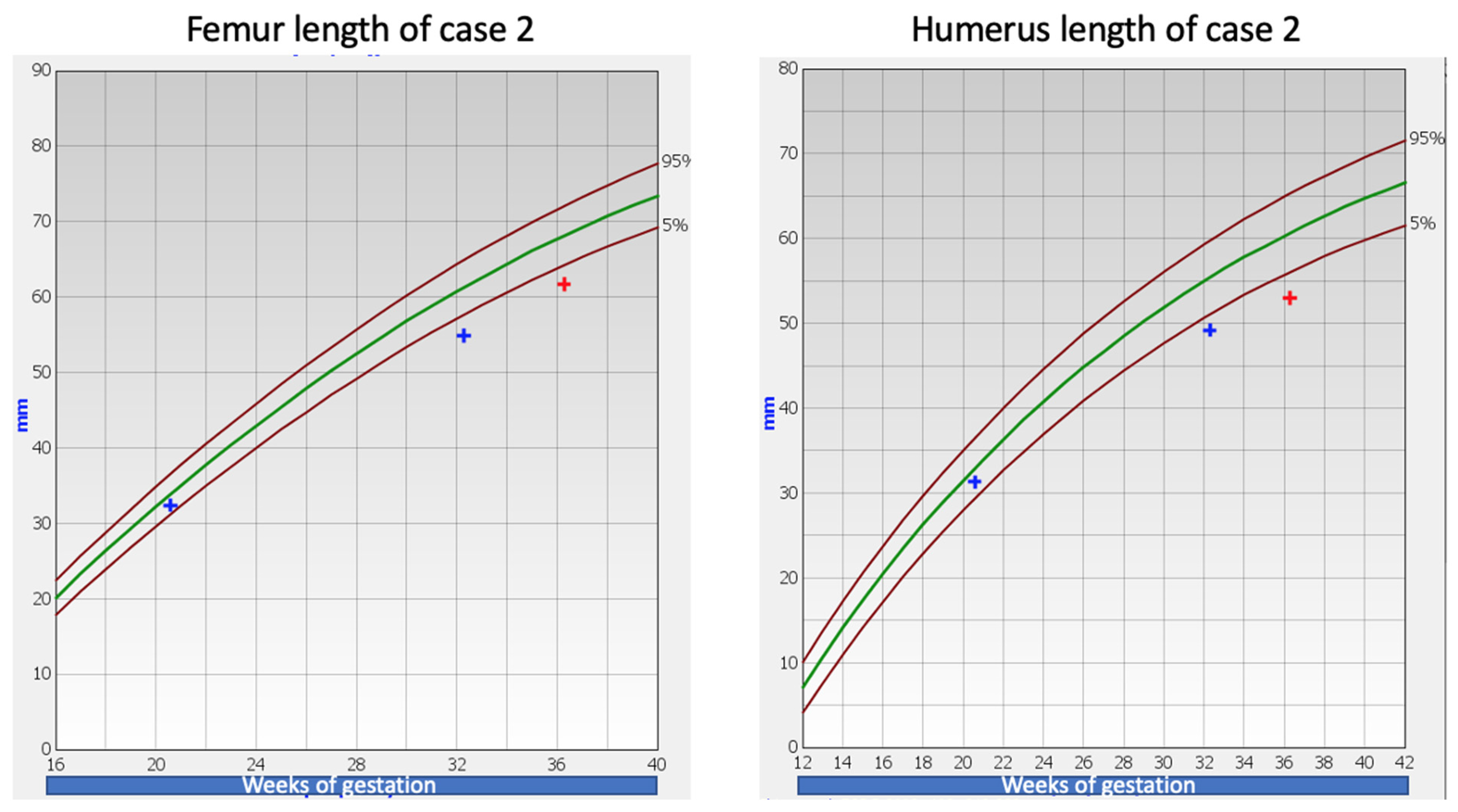 Children 09 01229 g002 550