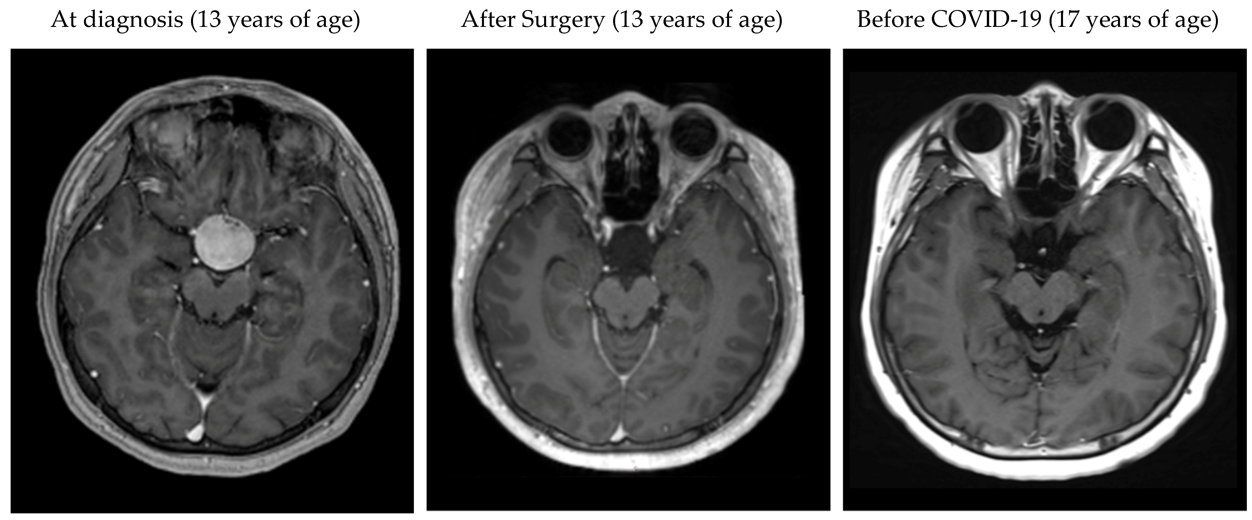 小児神経の画像診断 = Diagnostic Imaging of Infan…
