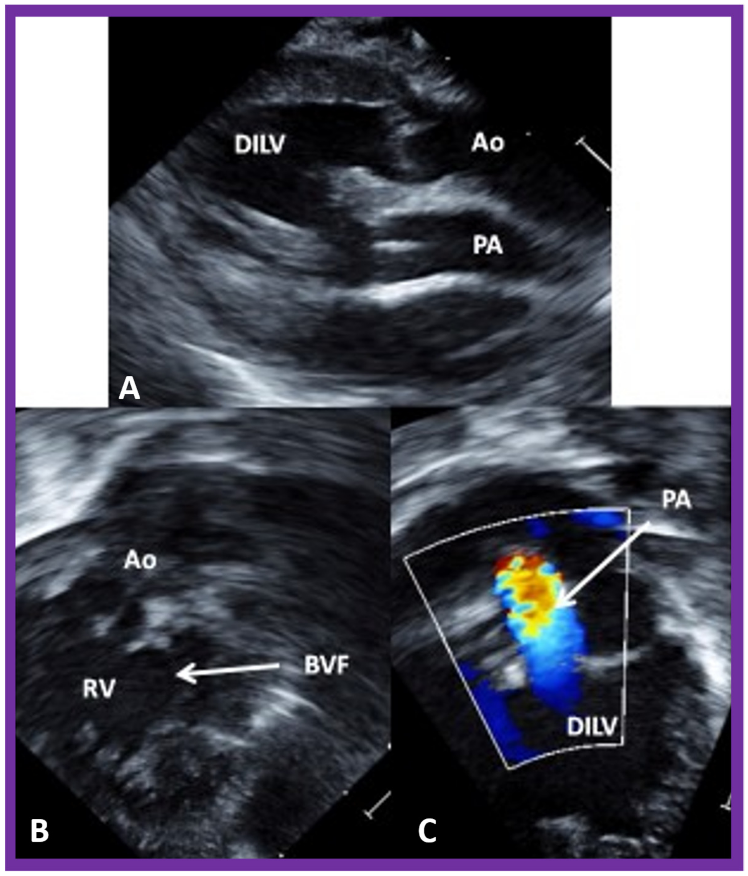 Children 09 01274 g004