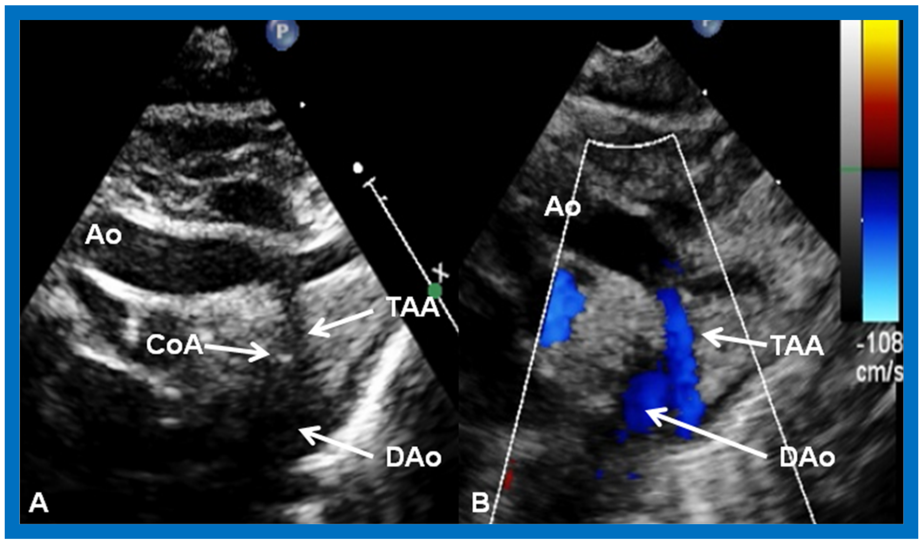 Children 09 01274 g005