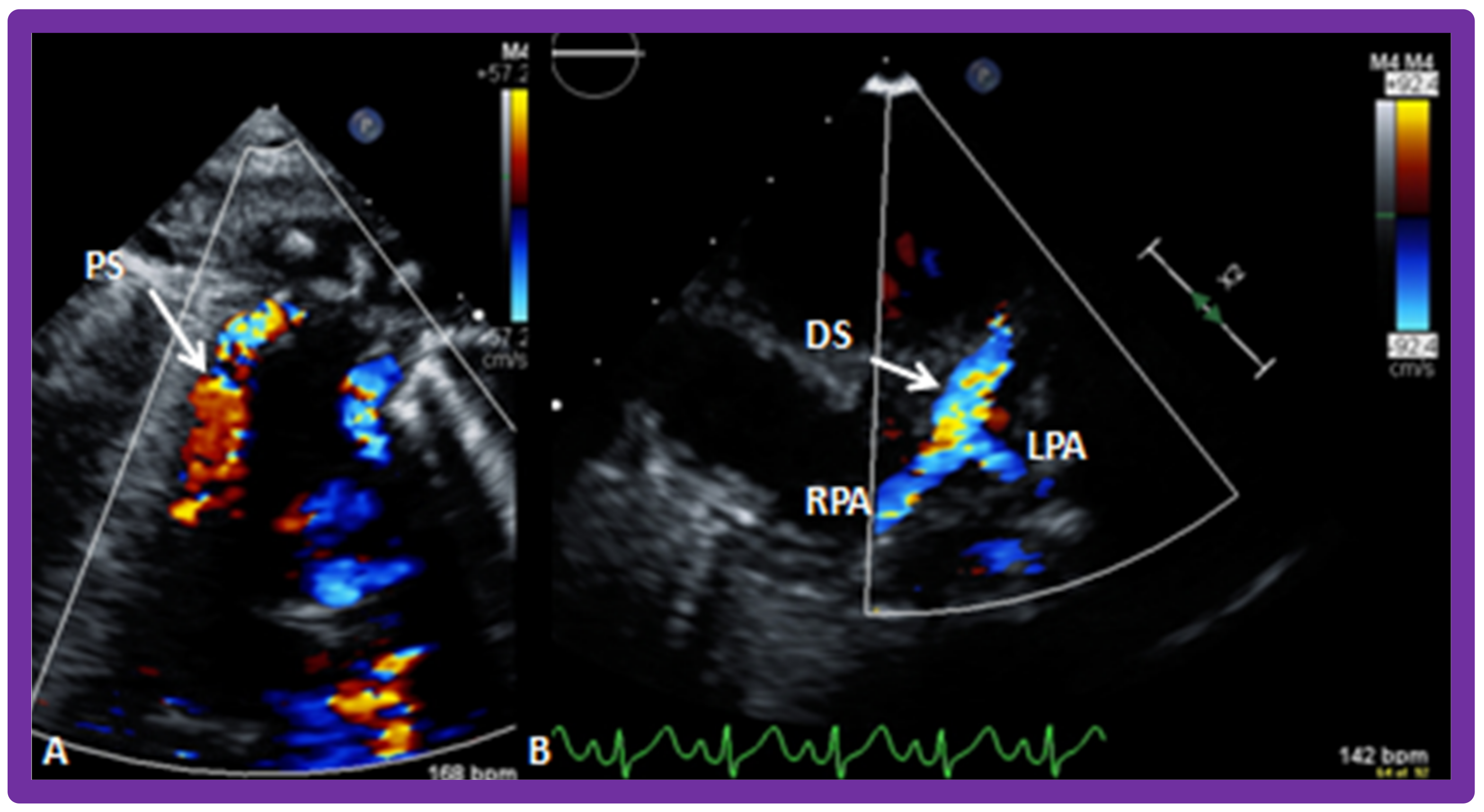 Children 09 01274 g008