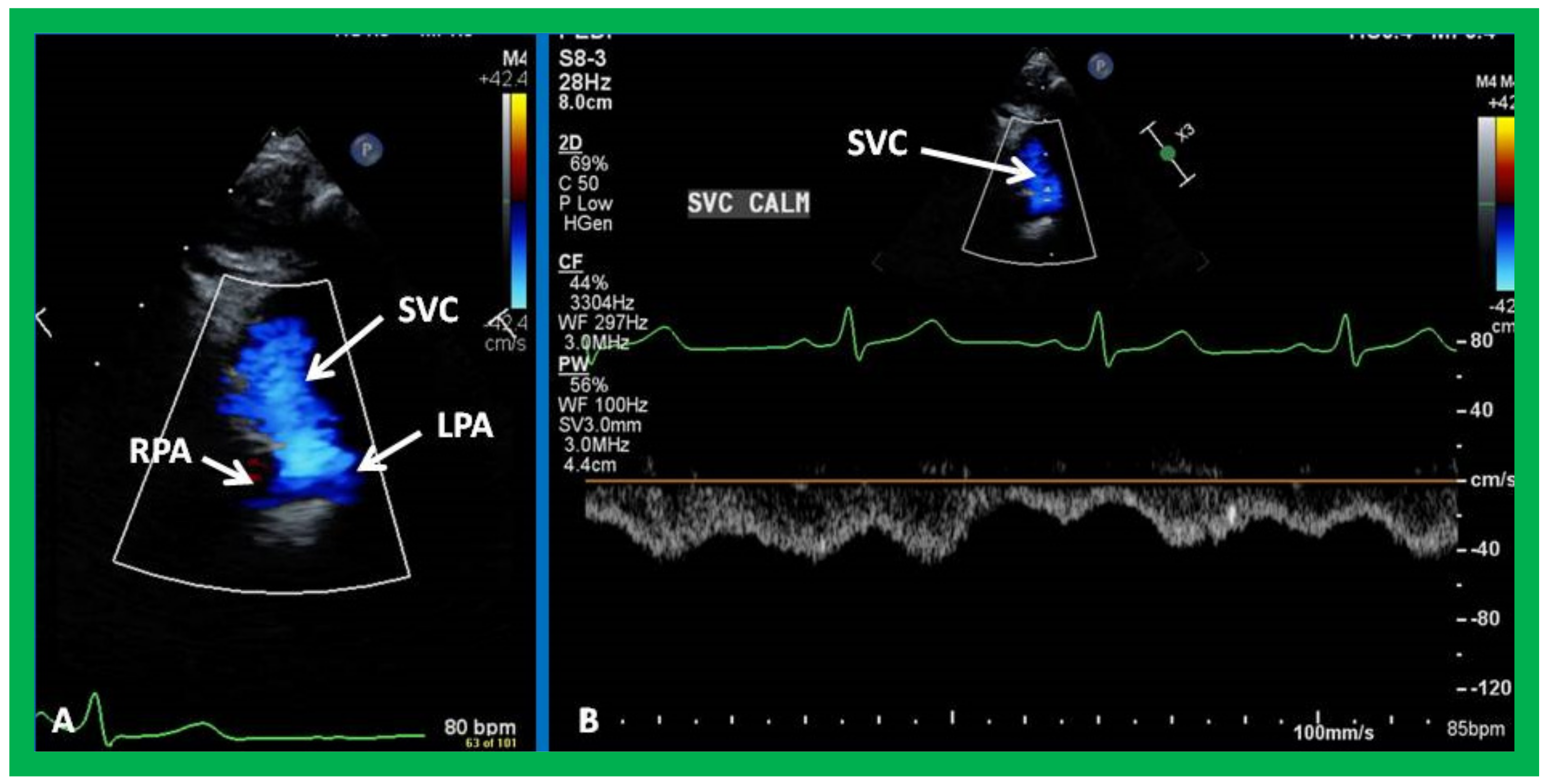 Children 09 01274 g011