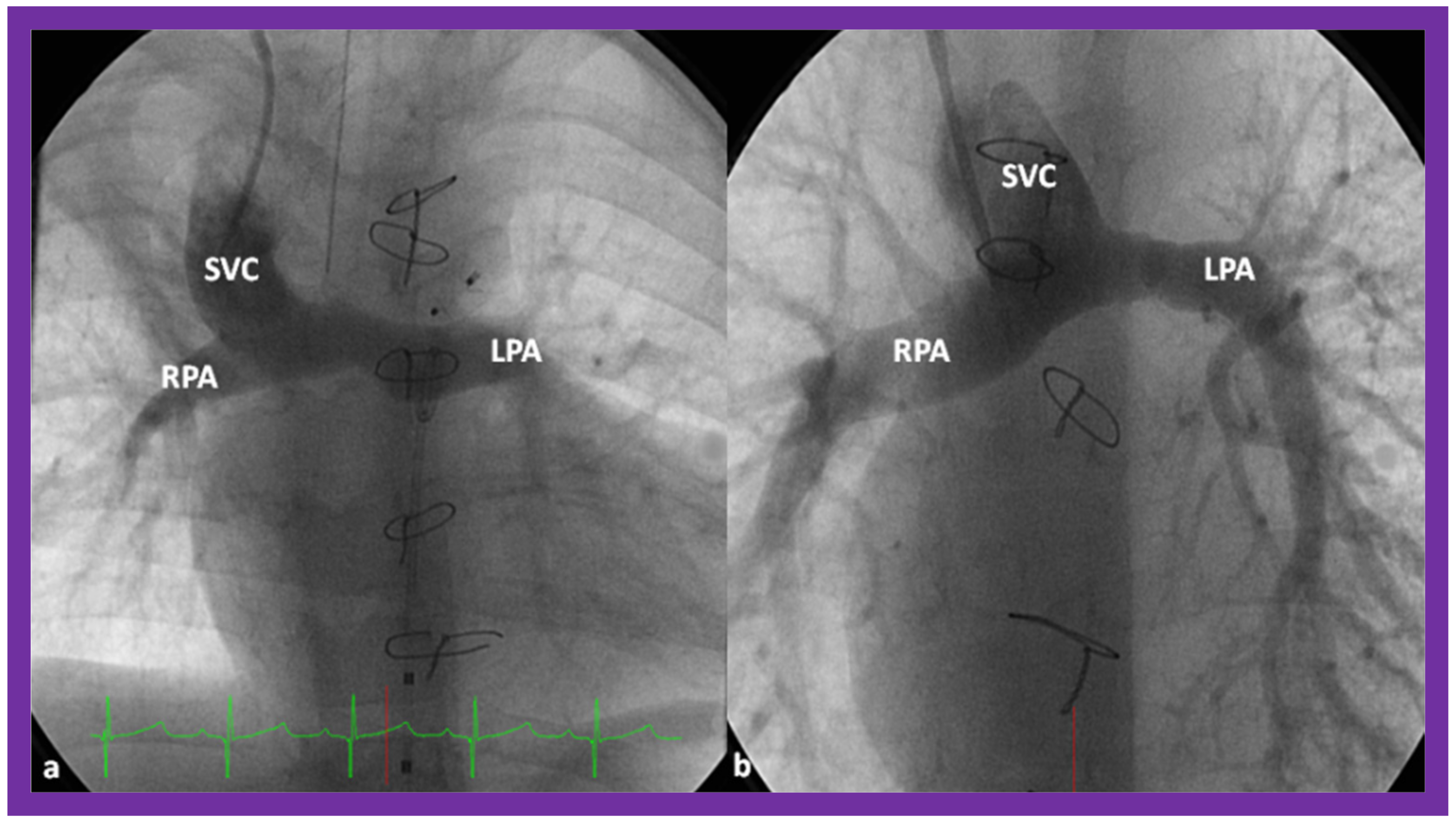 Children 09 01274 g012