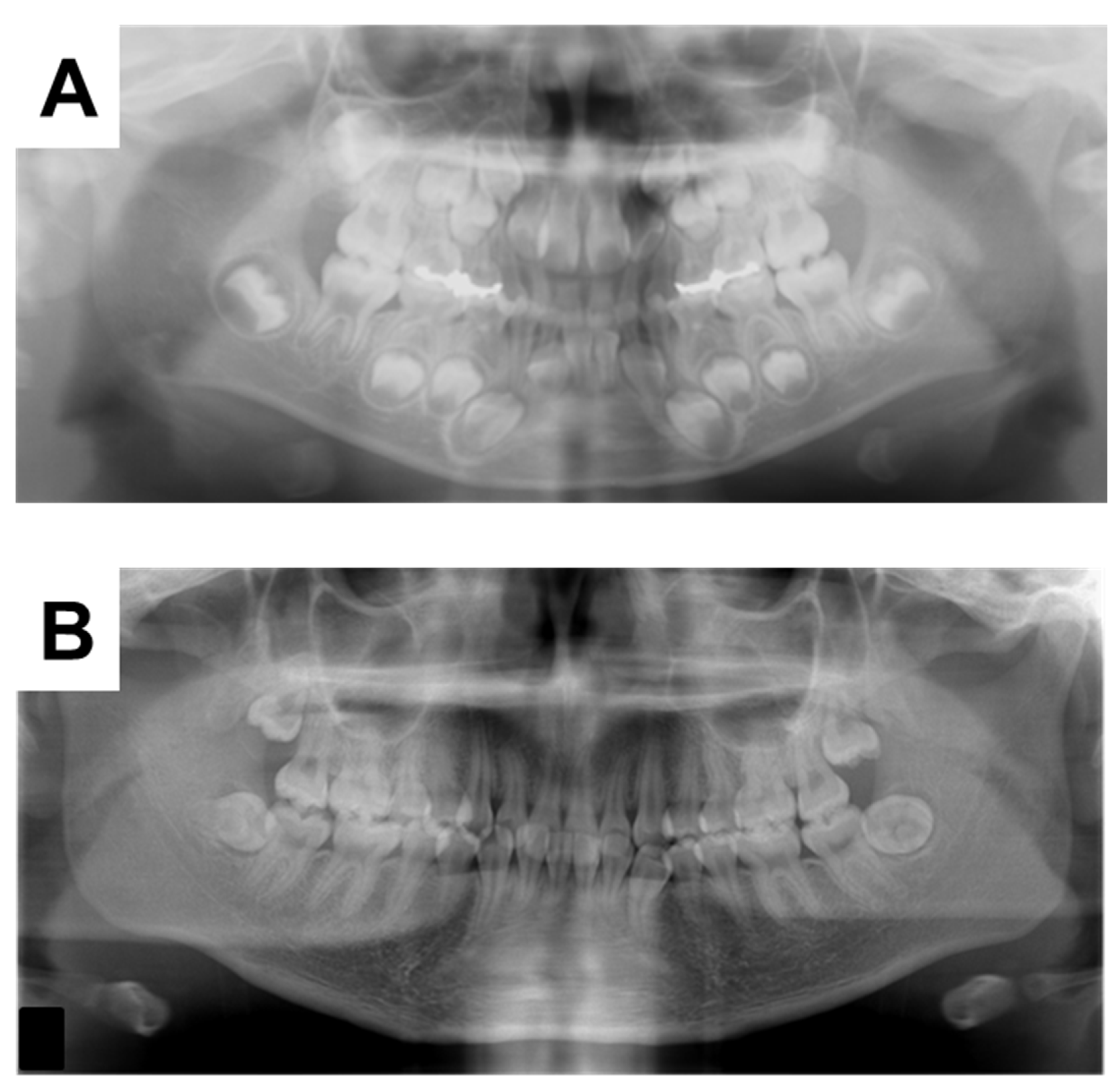 Children 09 01304 g005