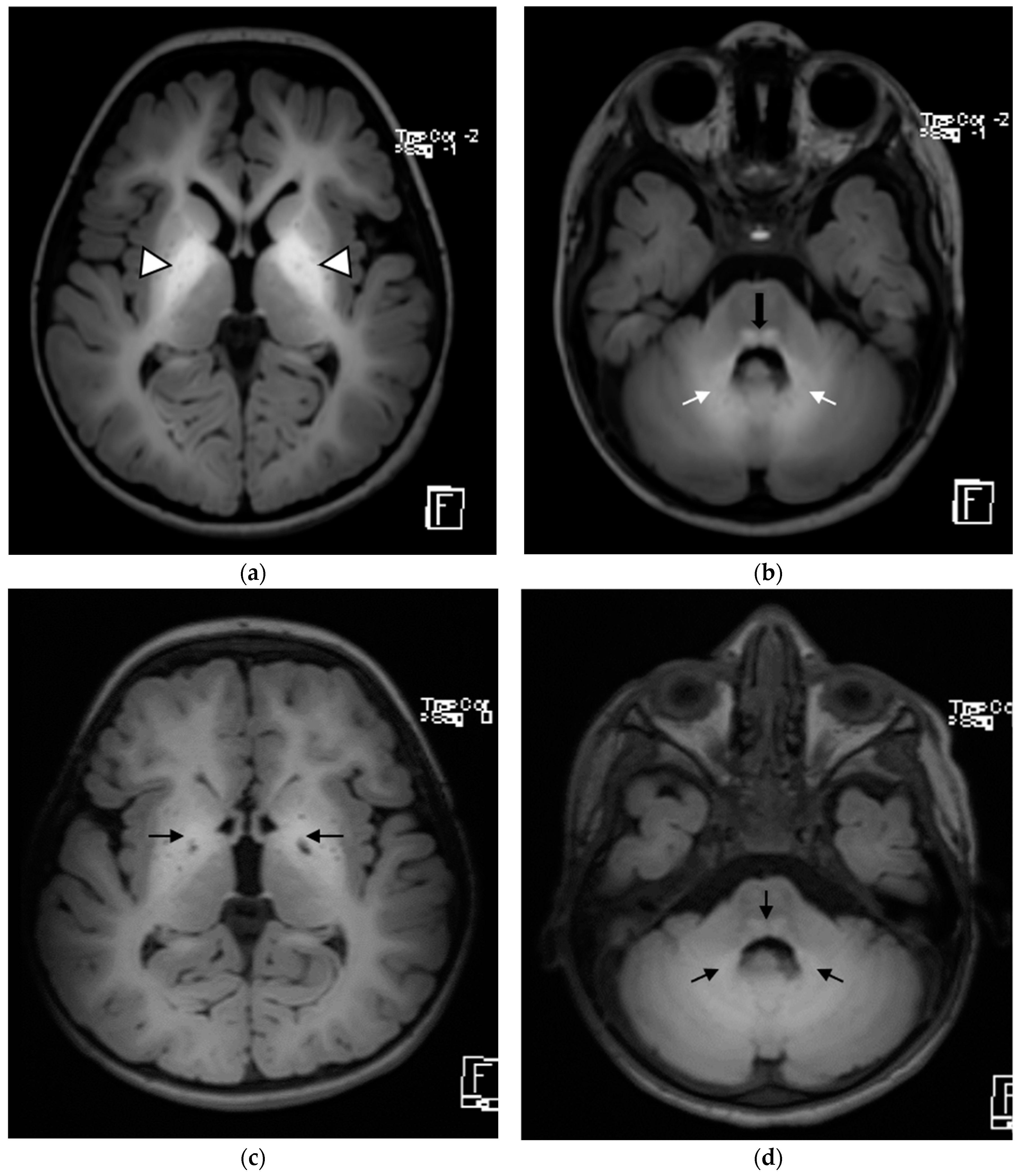 Children 09 01335 g002