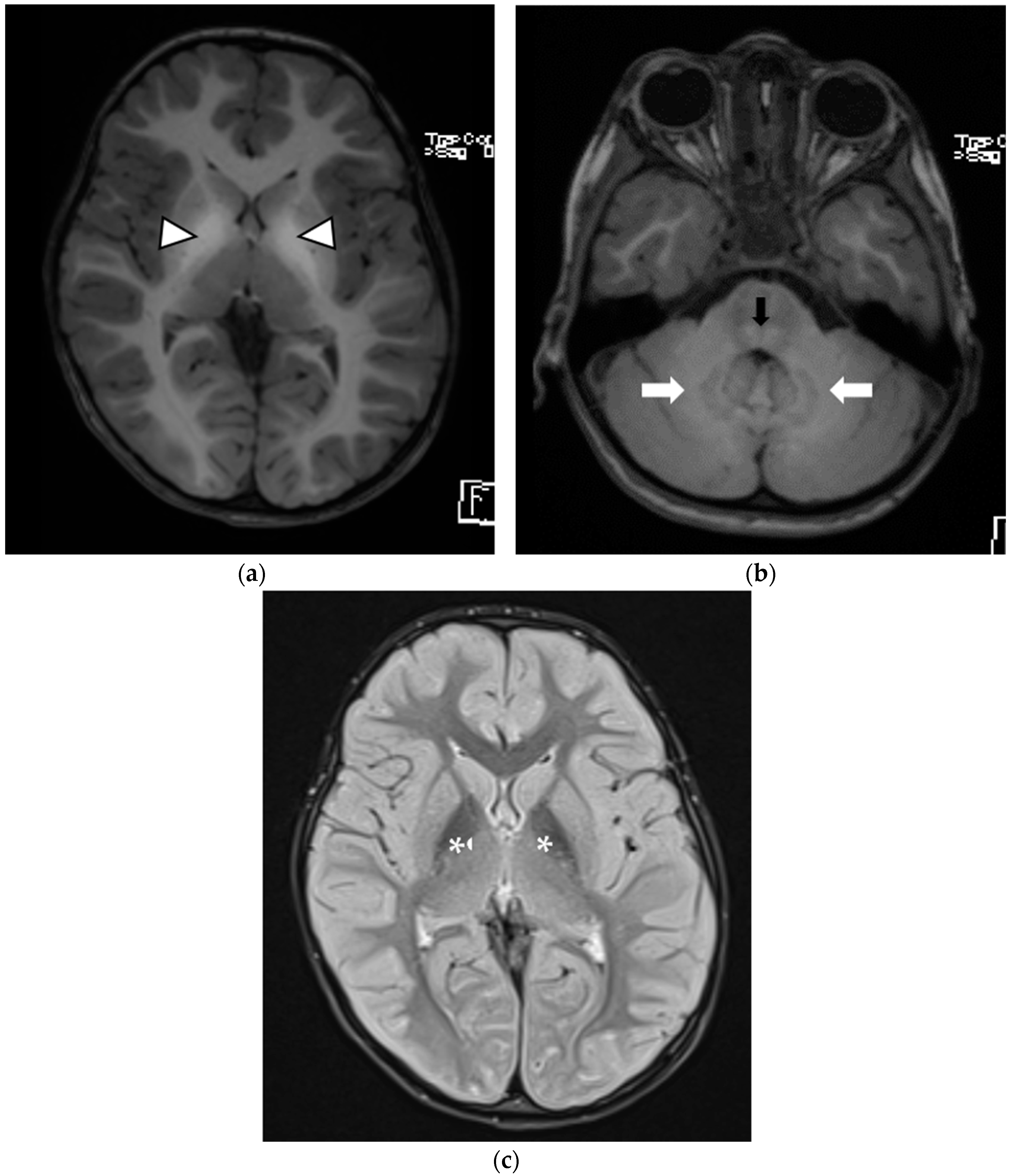 Children 09 01335 g003