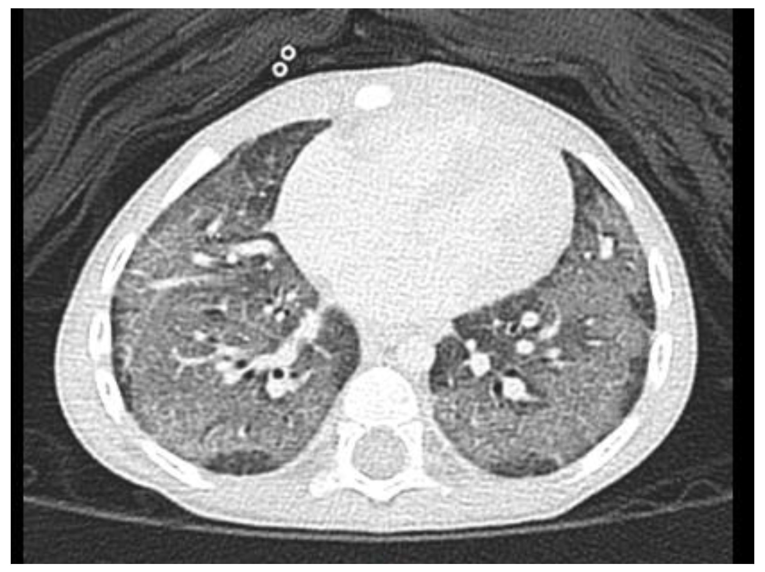 Children 09 01435 g003