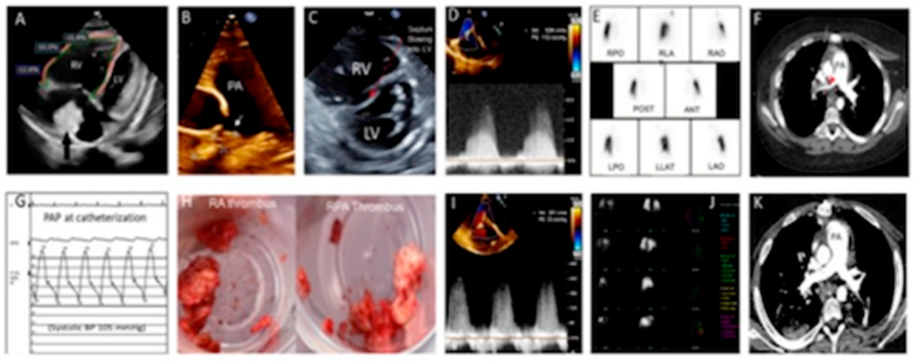 Children 09 01444 g002 550