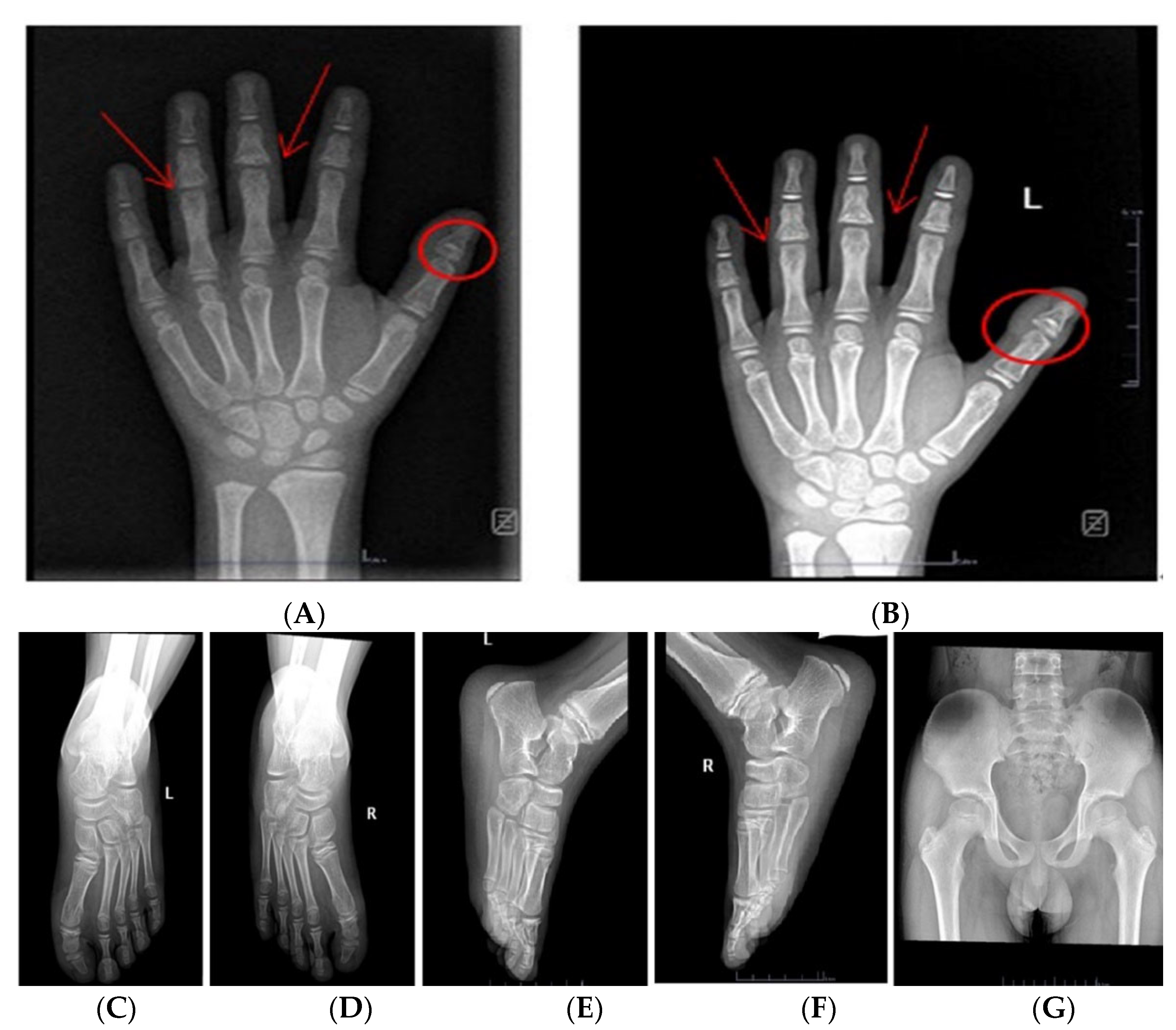 Children 09 01447 g002