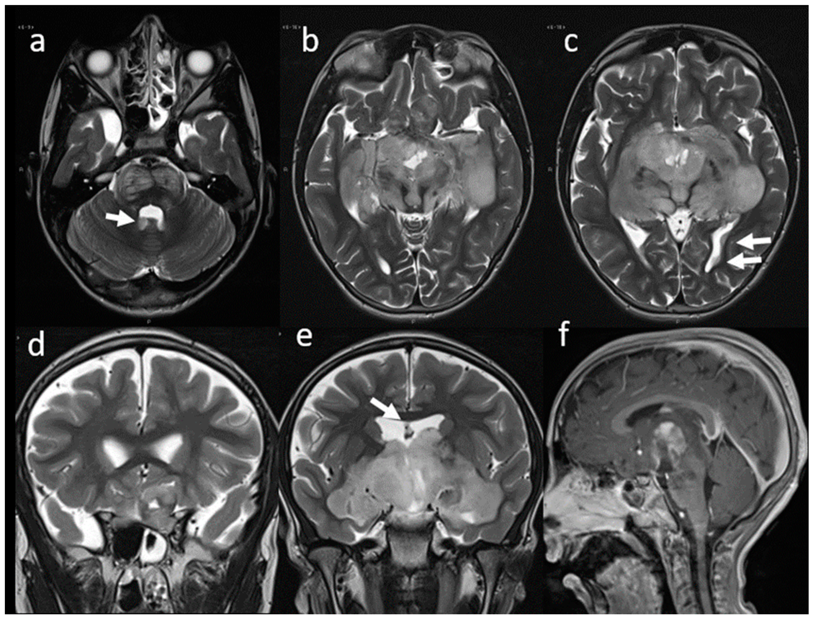 Children 09 01455 g002