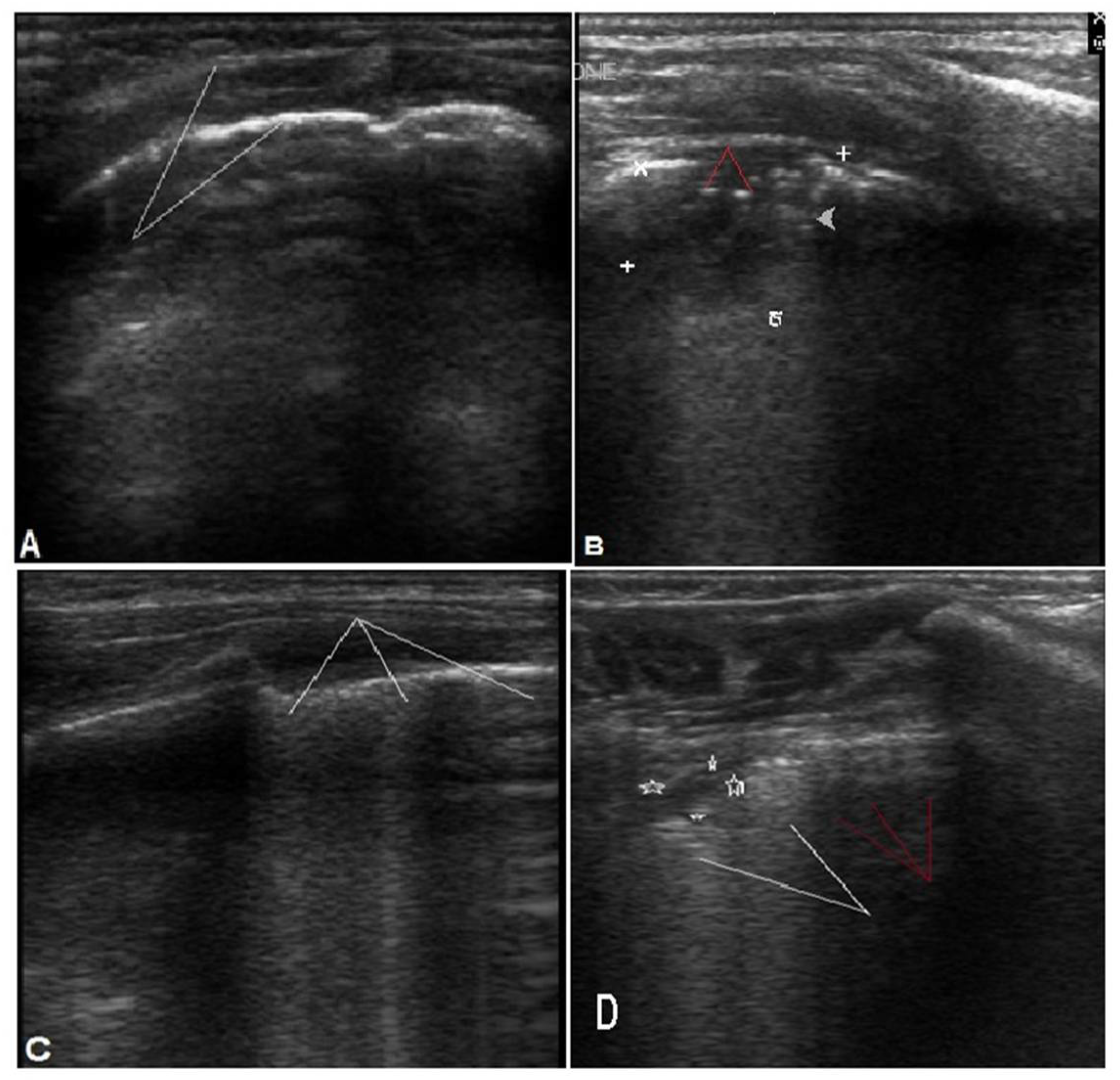 Children 09 01457 g002 Children 09 01457 g002