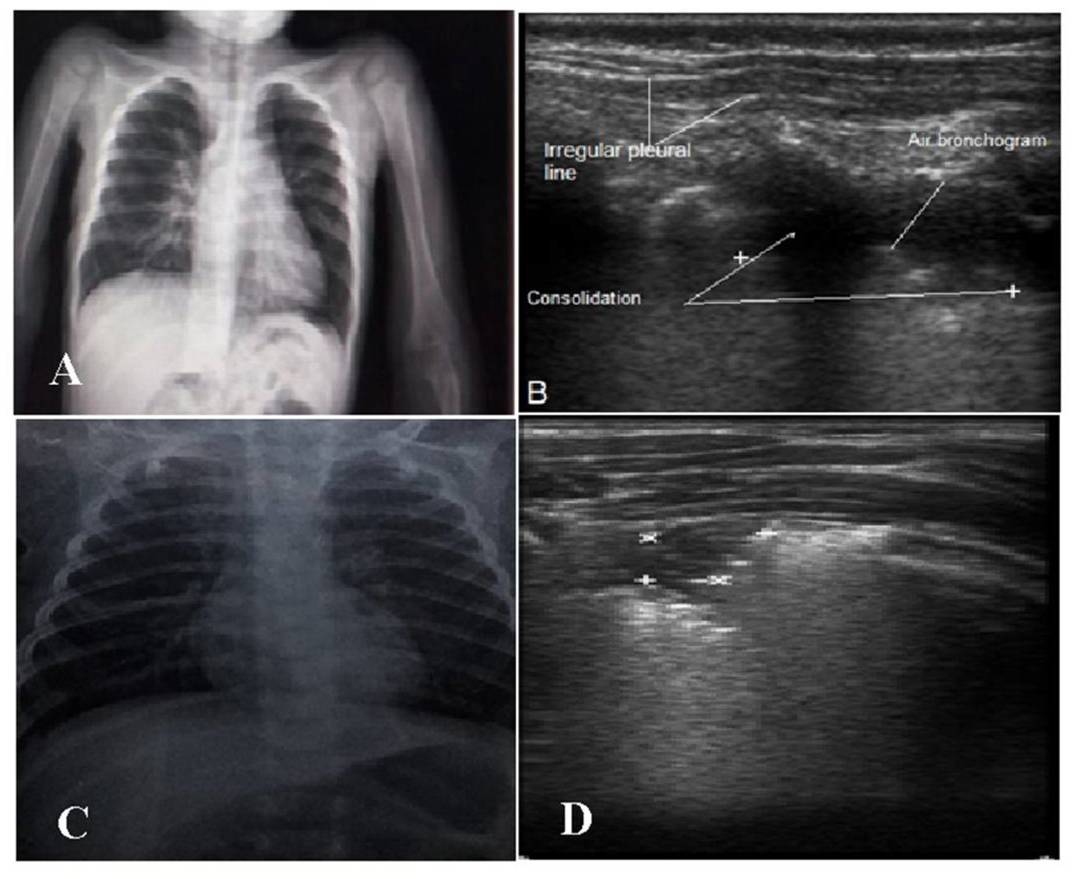 Children 09 01457 g003 Children 09 01457 g003