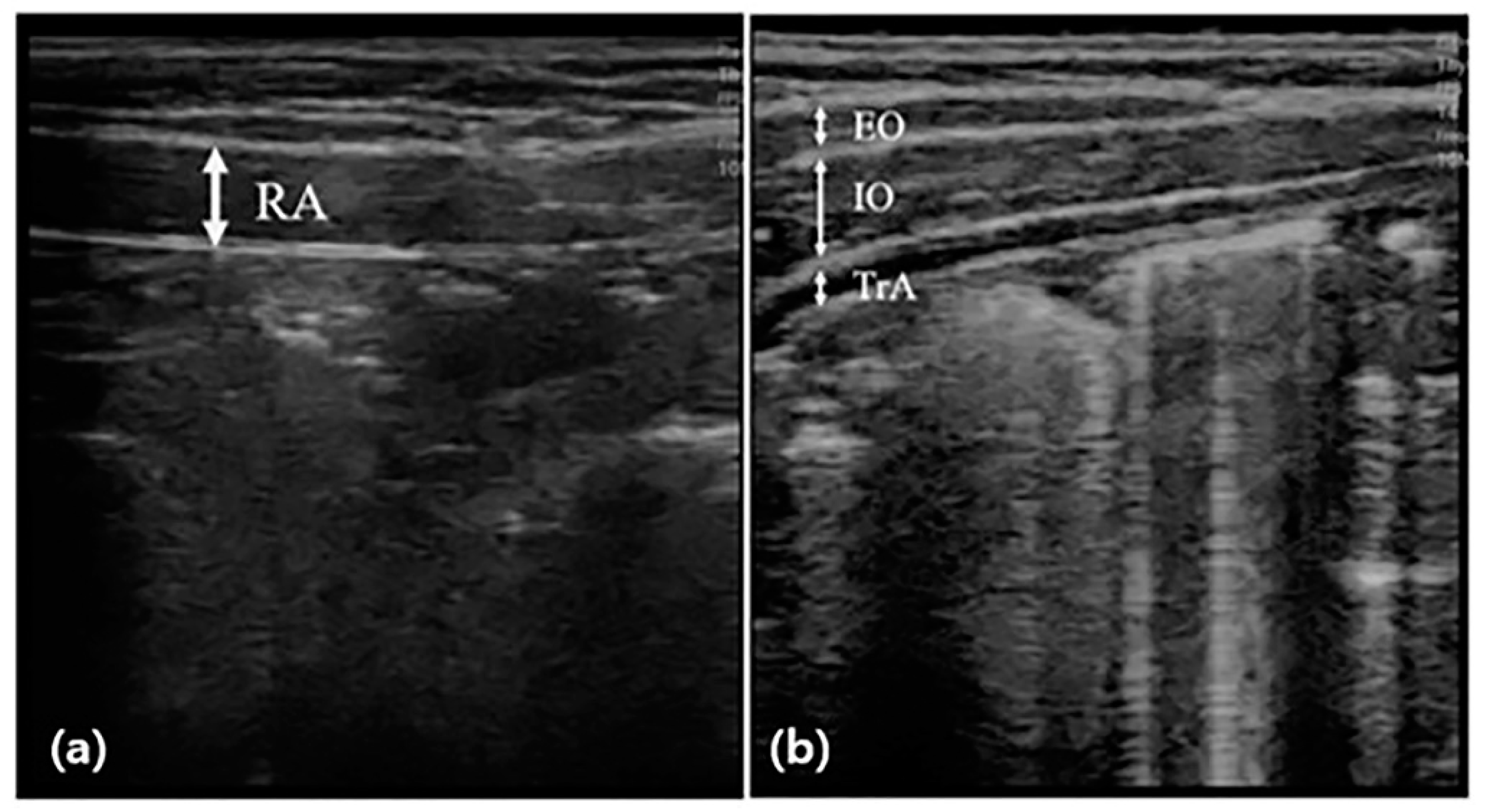 Children 09 01470 g001 Children 09 01470 g001