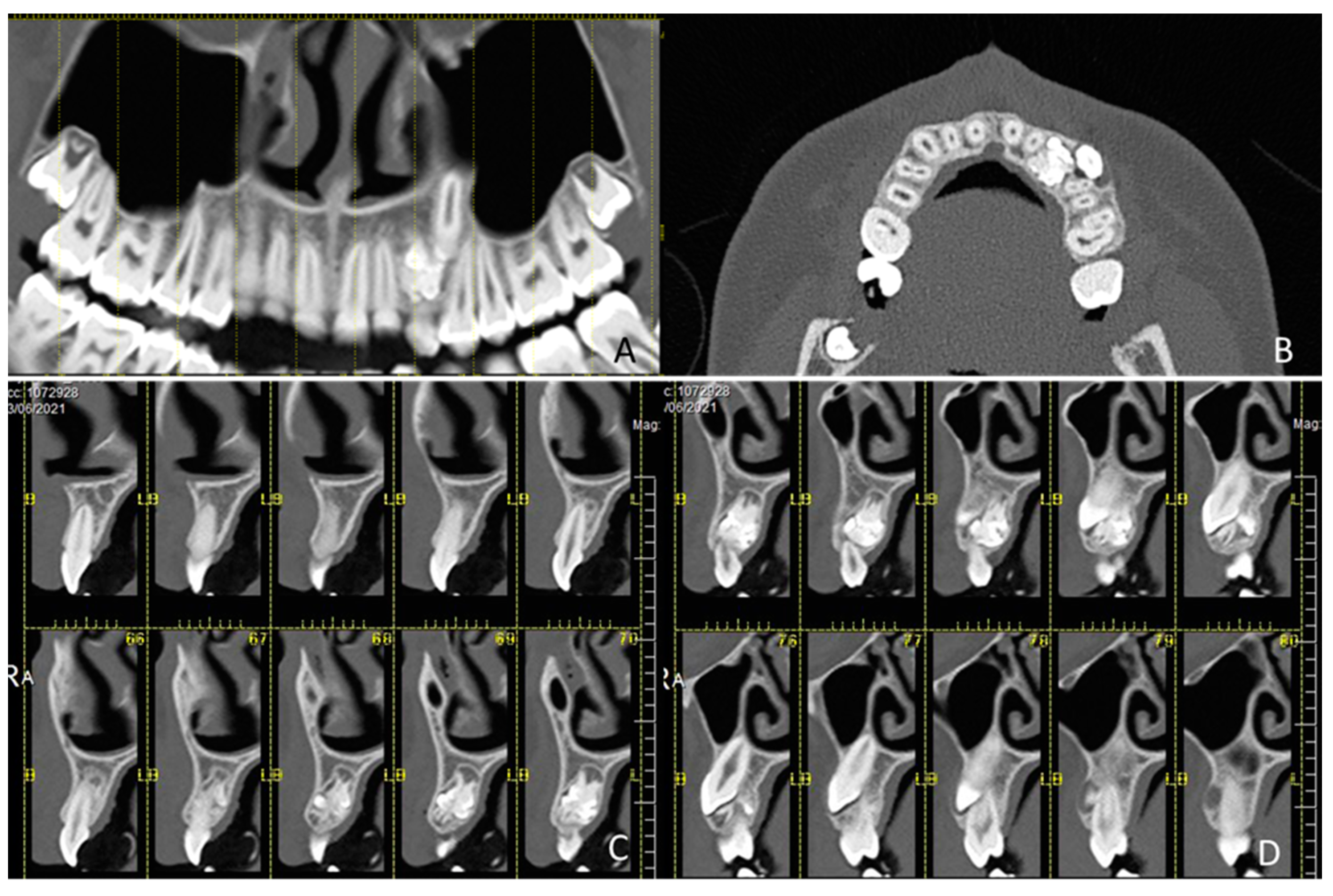 Children 09 01509 g001 Children 09 01509 g001