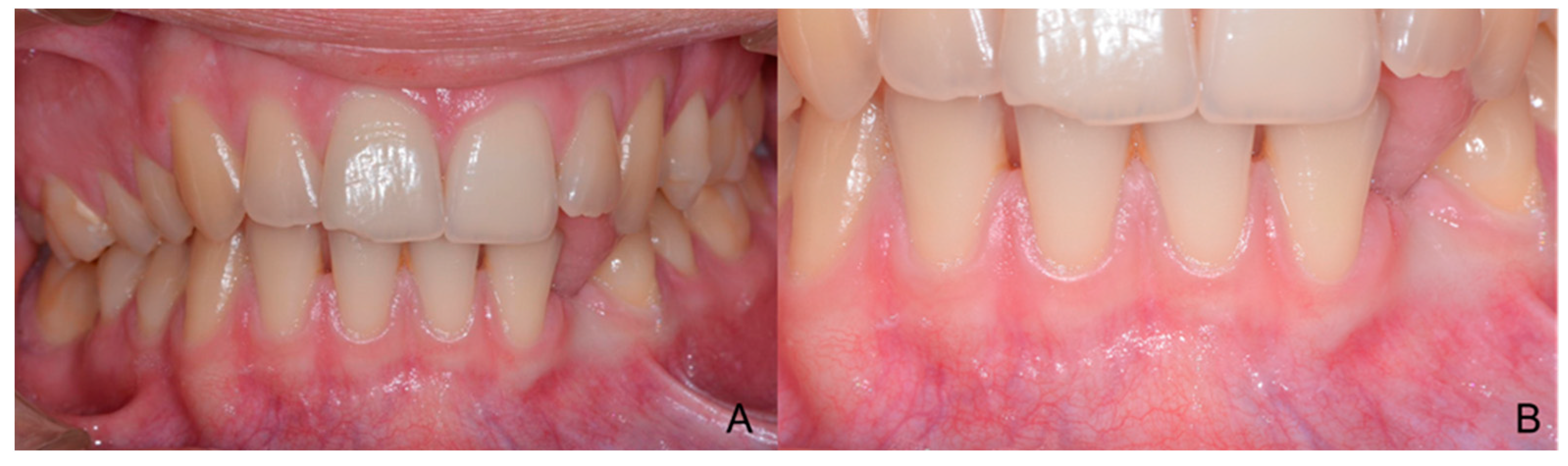 Children 09 01509 g011 Children 09 01509 g011