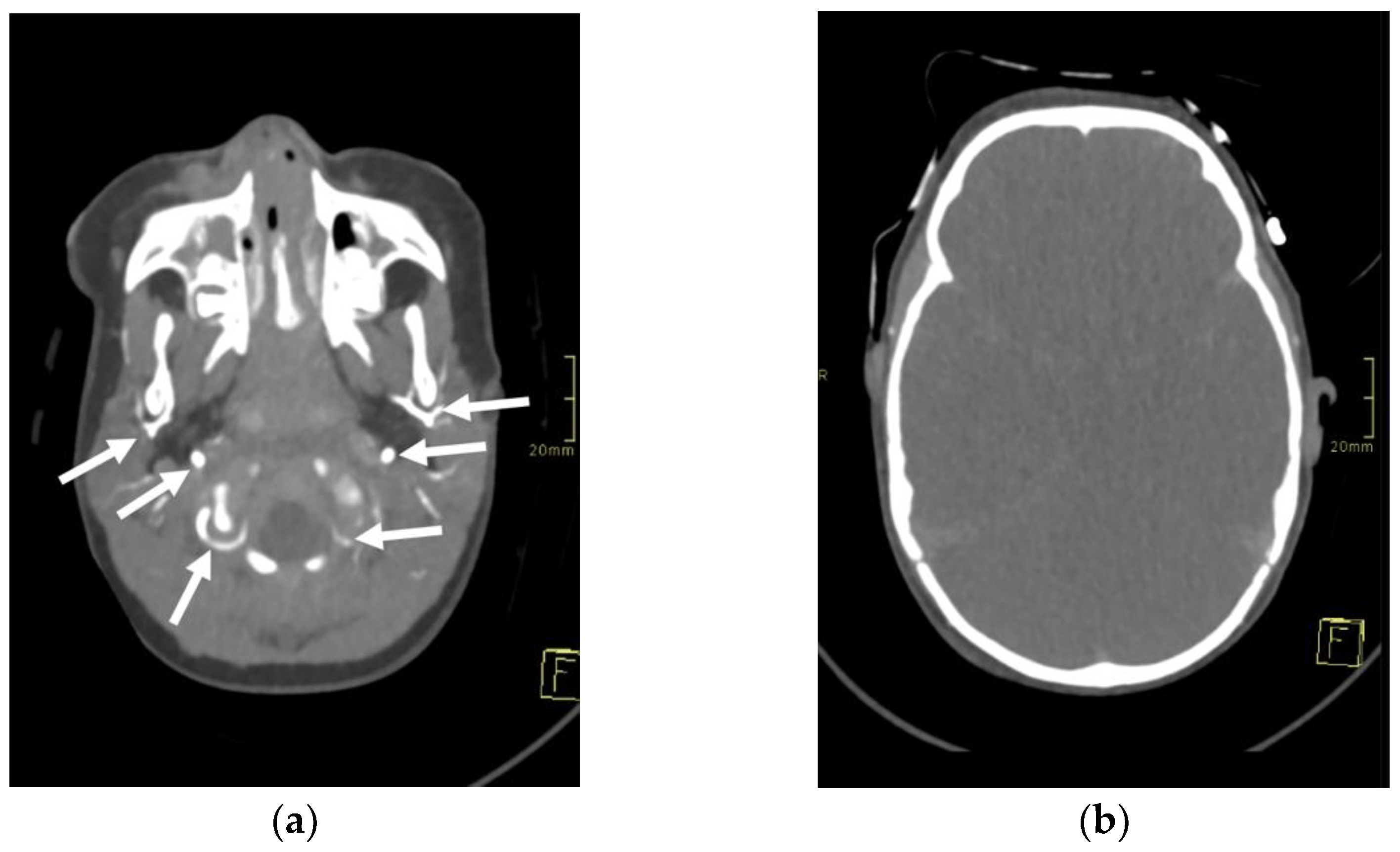 Children 09 01525 g001