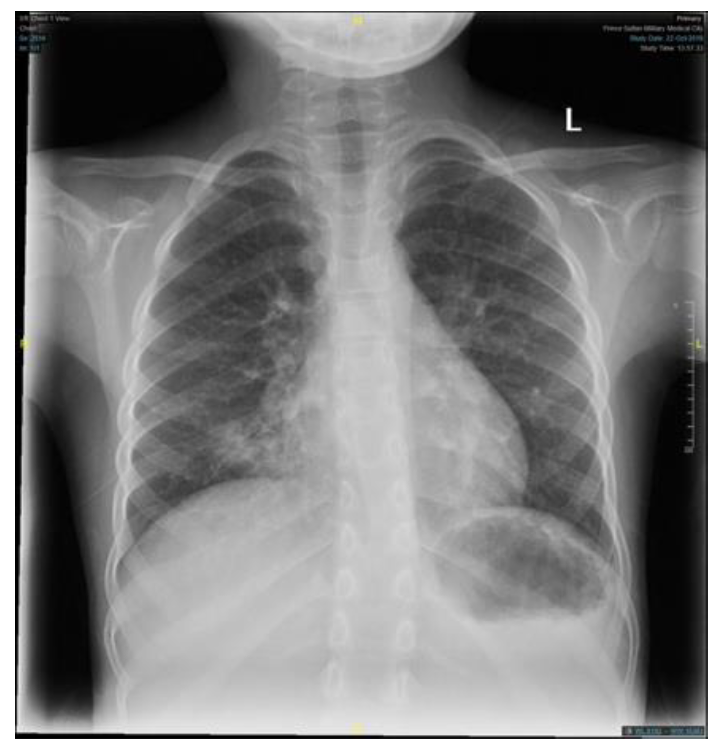 Children 09 01534 g002