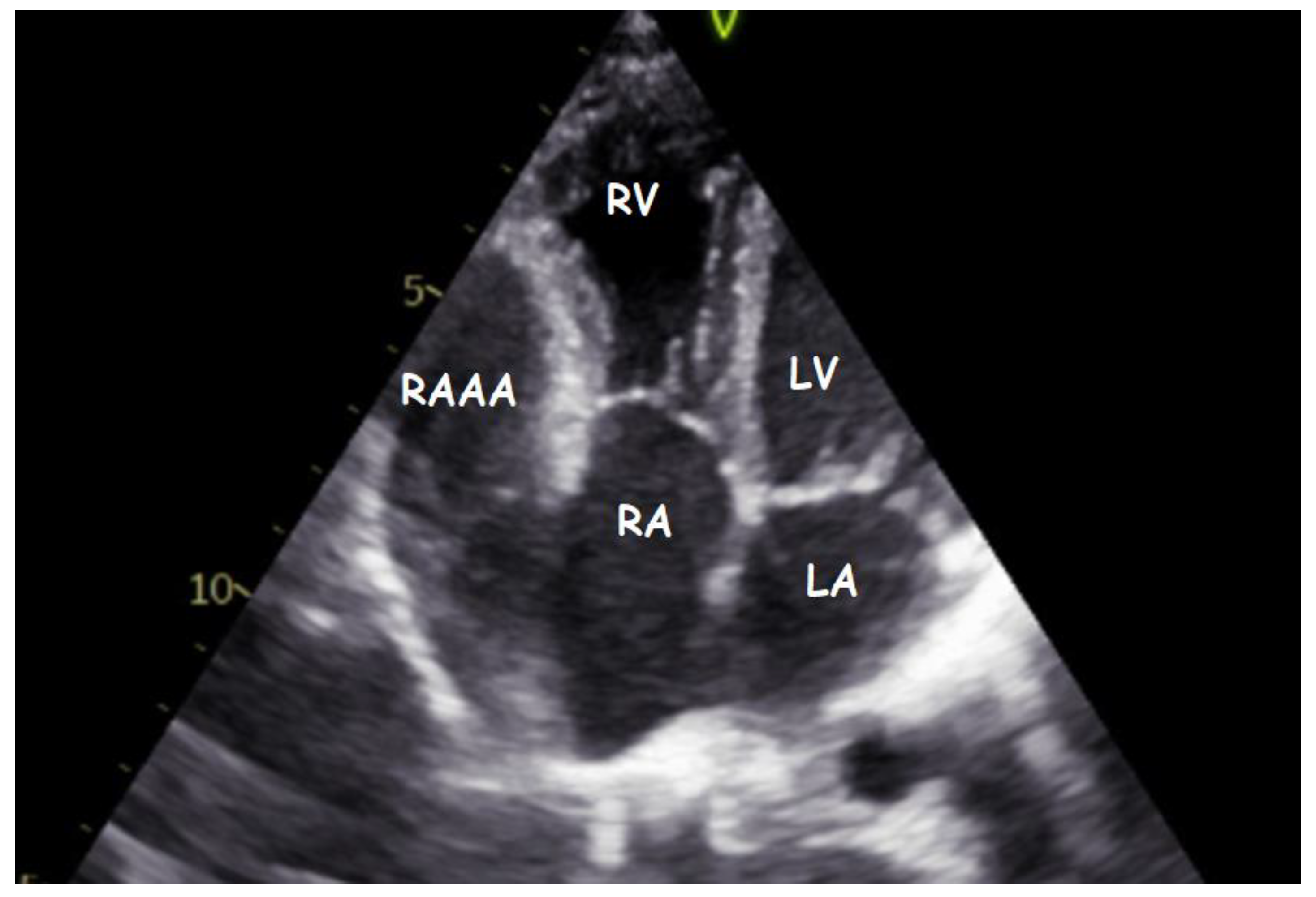 Children 09 01552 g002