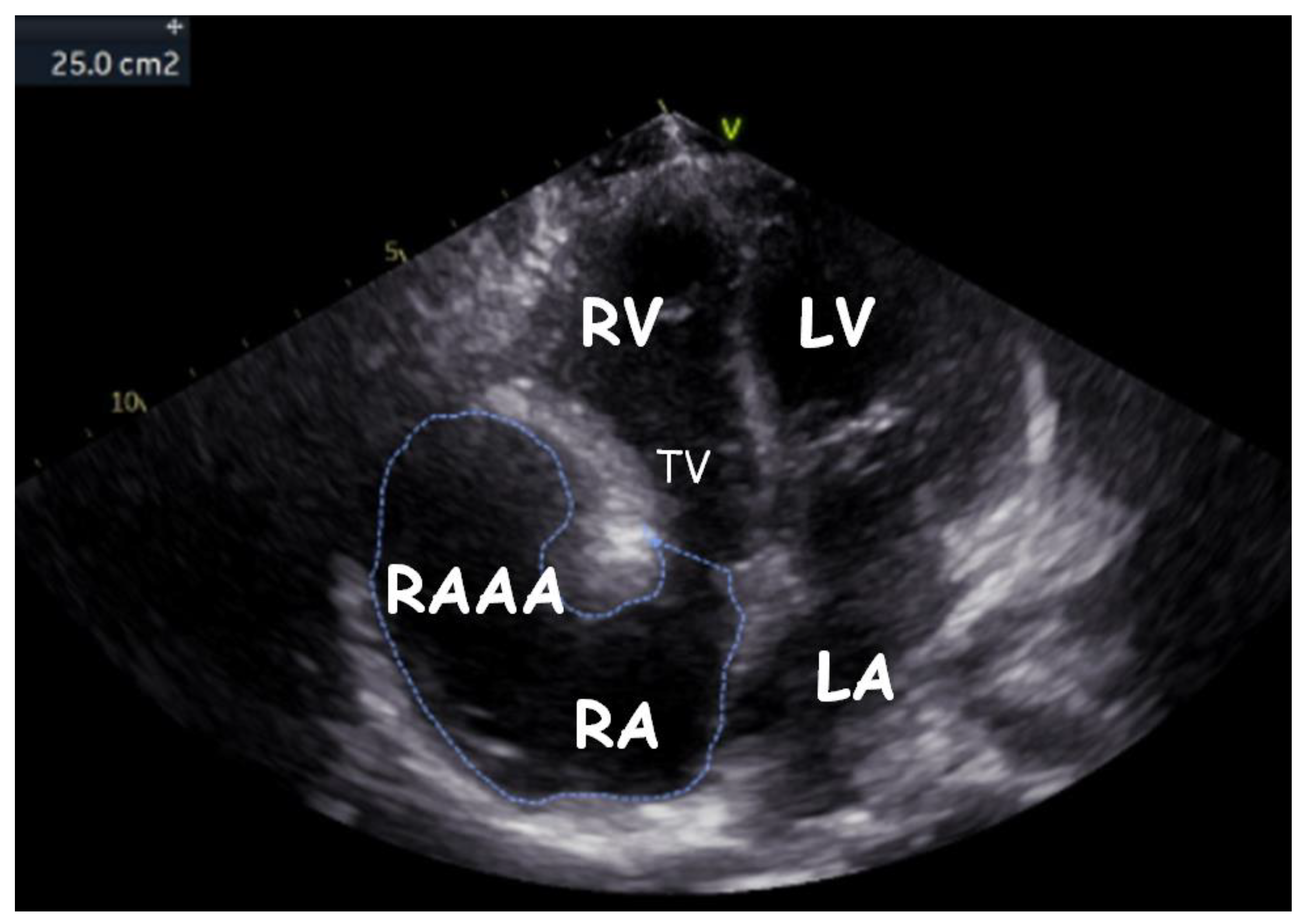 Children 09 01552 g006