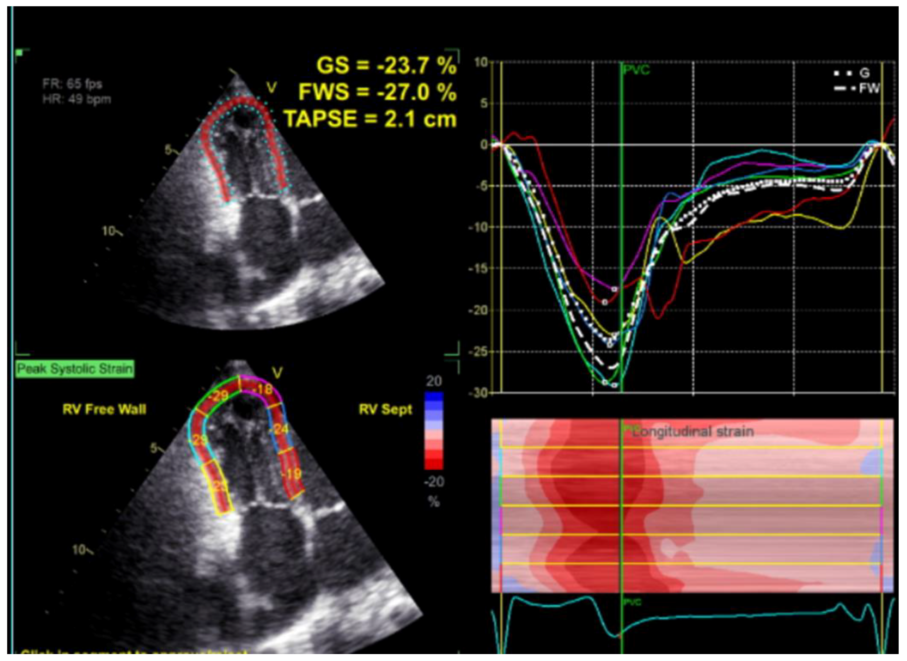 Children 09 01552 g007