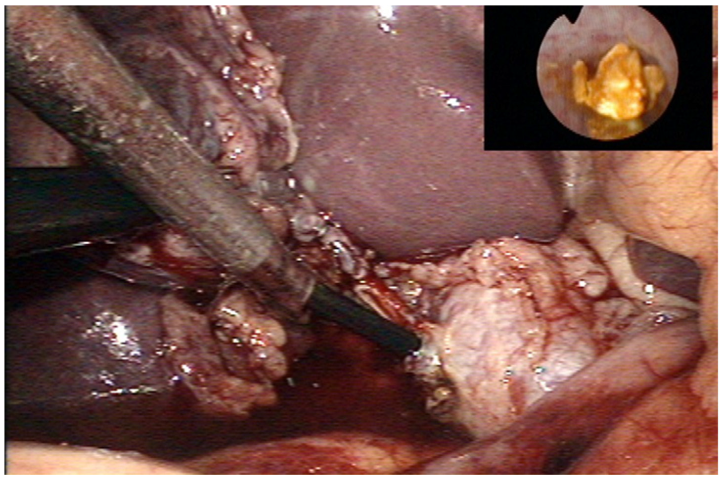 Children 09 01583 g002 Children 09 01583 g002