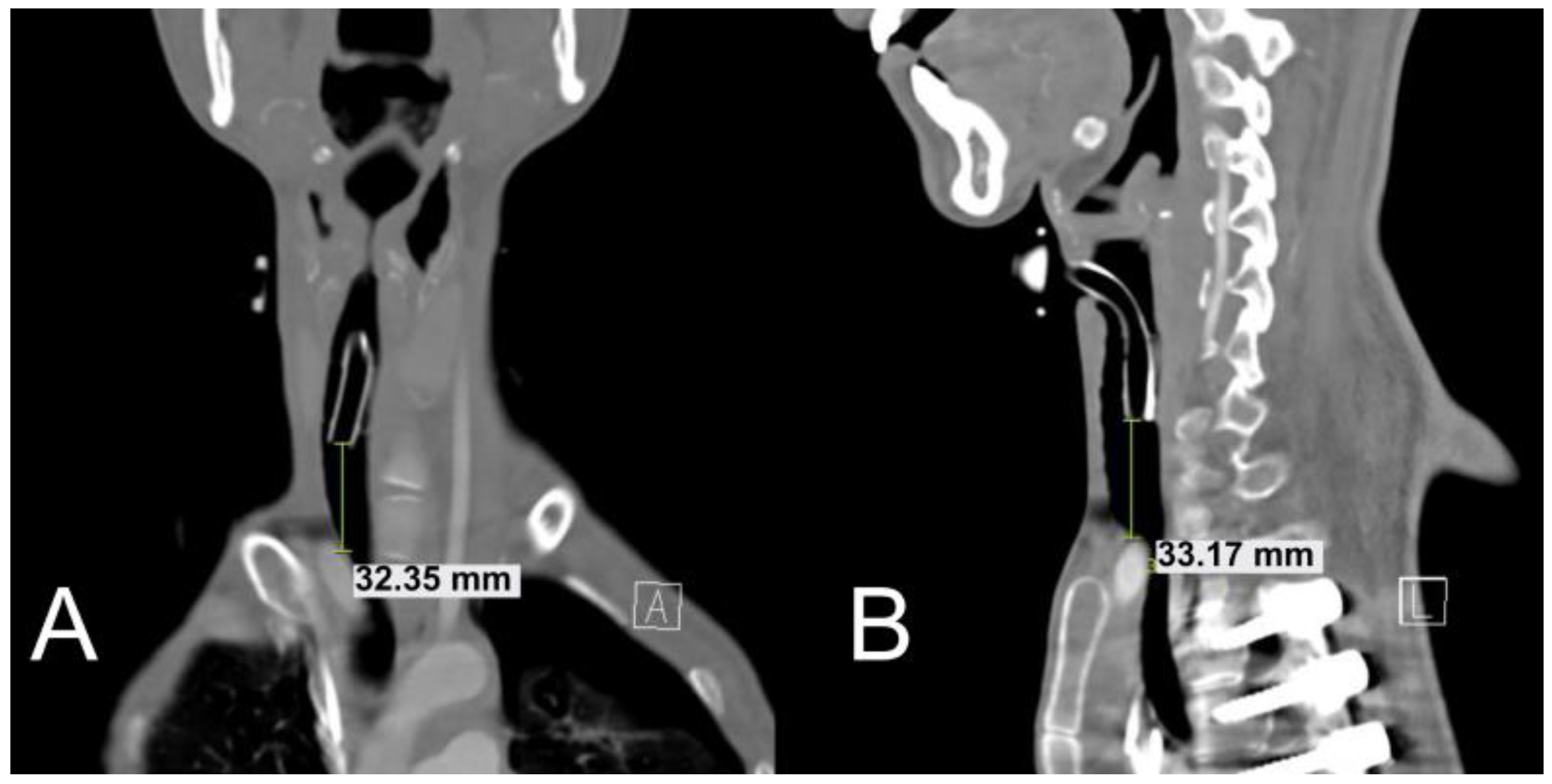 Children 09 01603 g002 Children 09 01603 g002