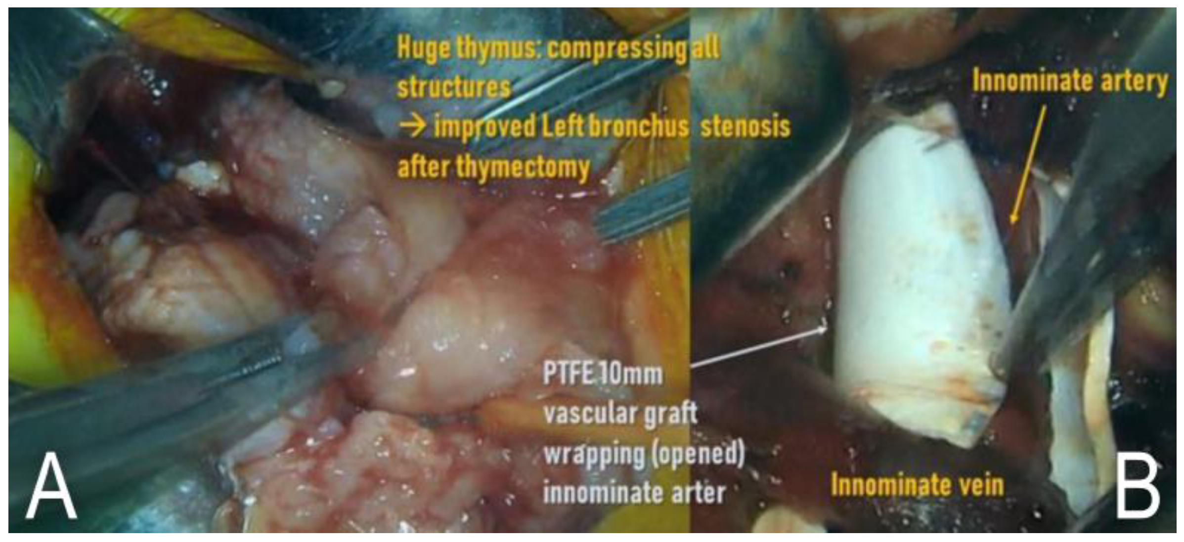 Children 09 01603 g004 Children 09 01603 g004