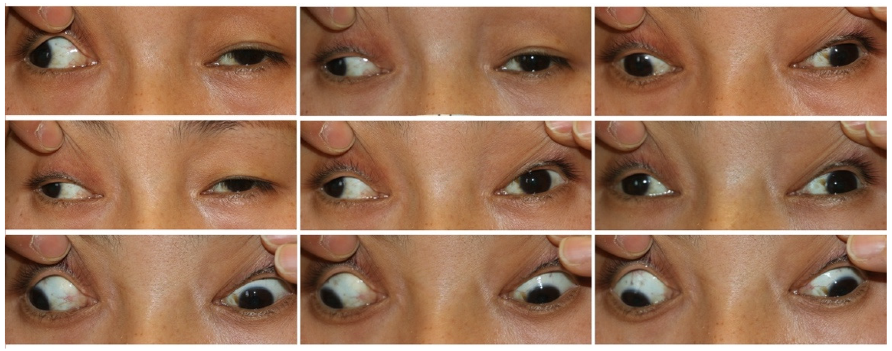 Children 09 01605 g002