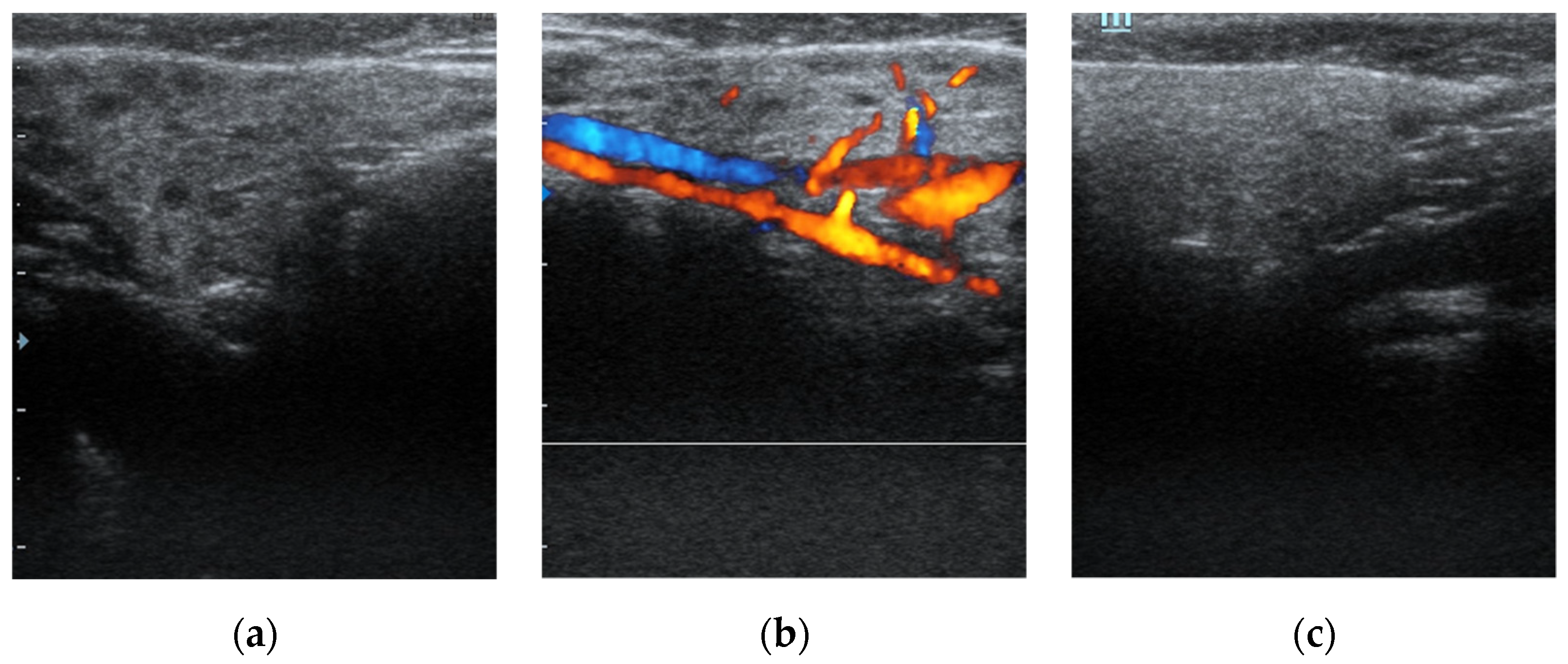 Children 09 01632 g001