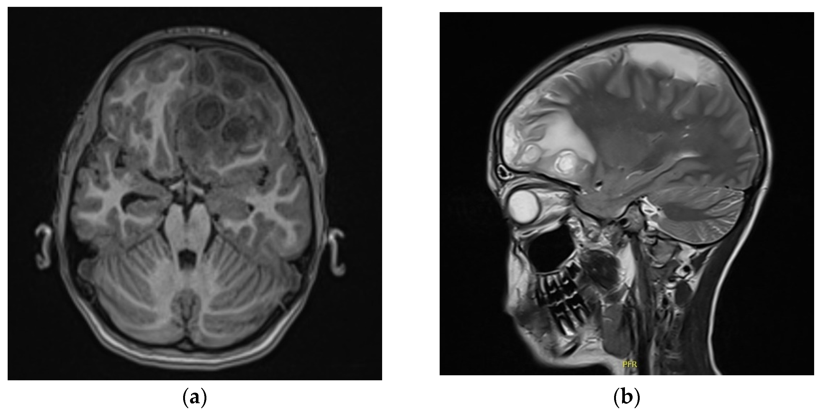 Children 09 01636 g002 Children 09 01636 g002