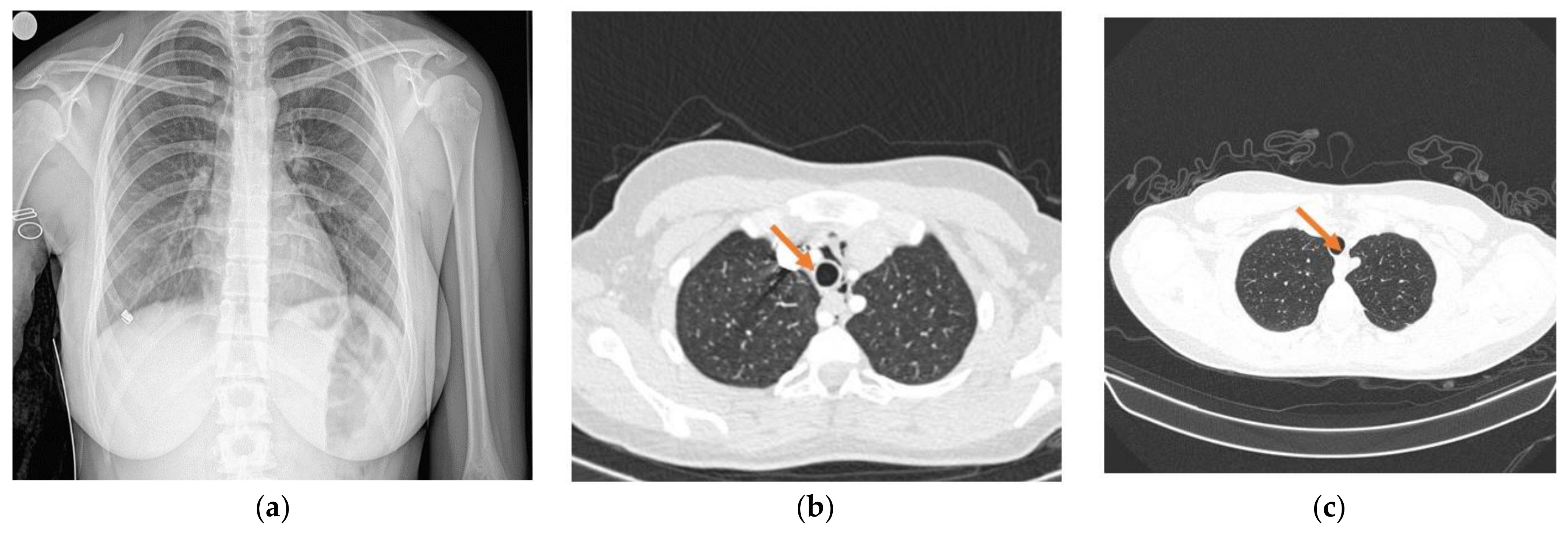 Children 09 01641 g001 Children 09 01641 g001
