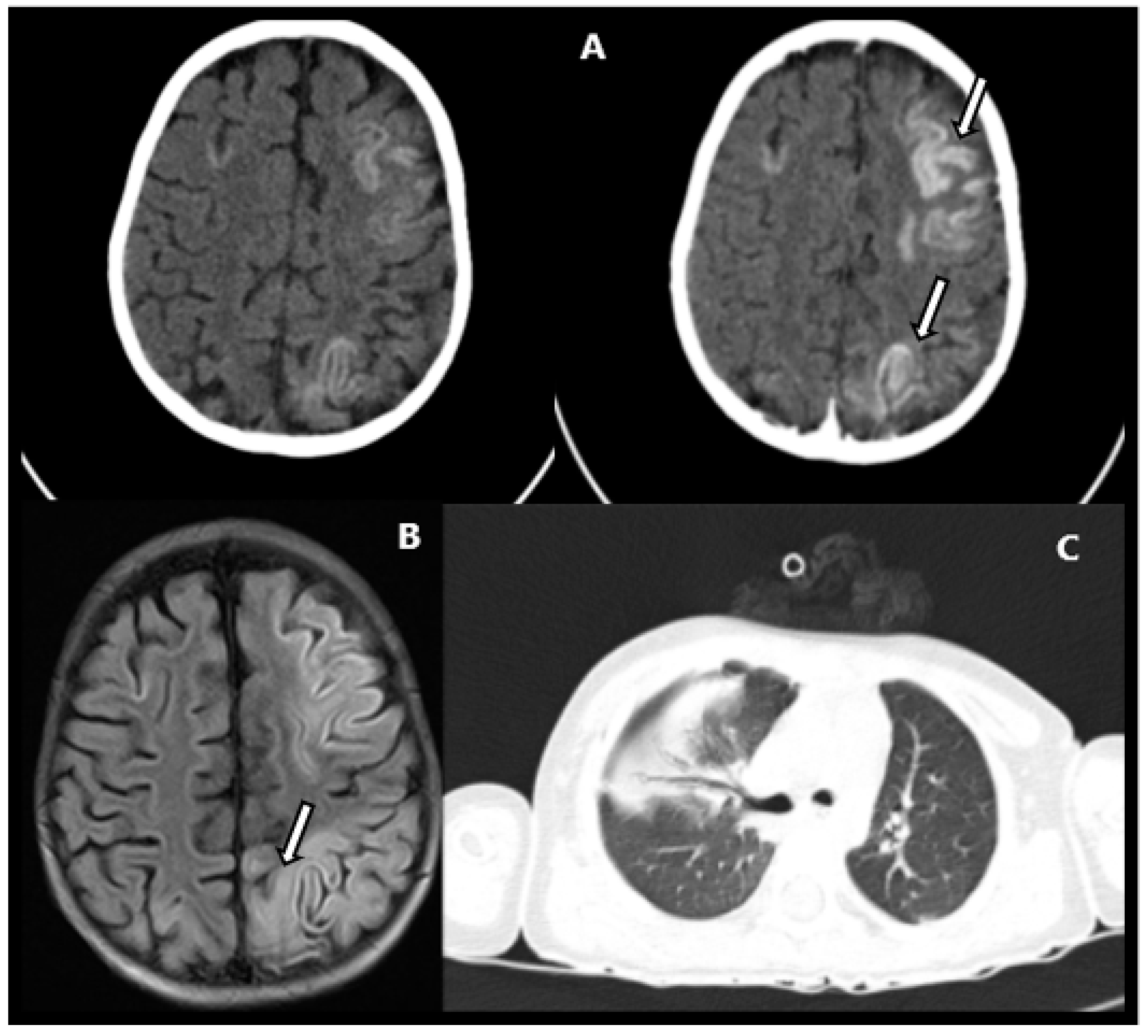 Children 09 01653 g001