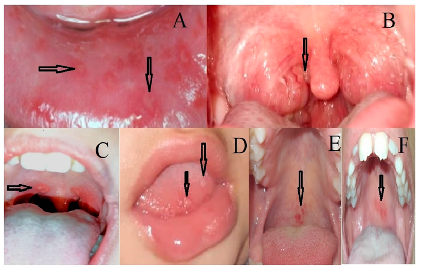 Children 09 01654 g001 Children 09 01654 g001