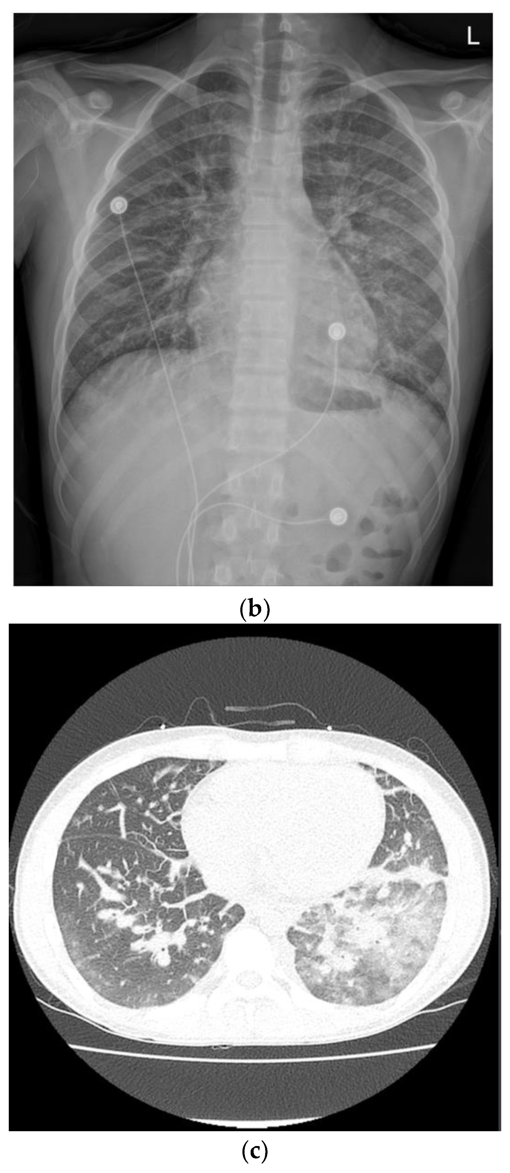 Children 09 01663 g001b Children 09 01663 g001b